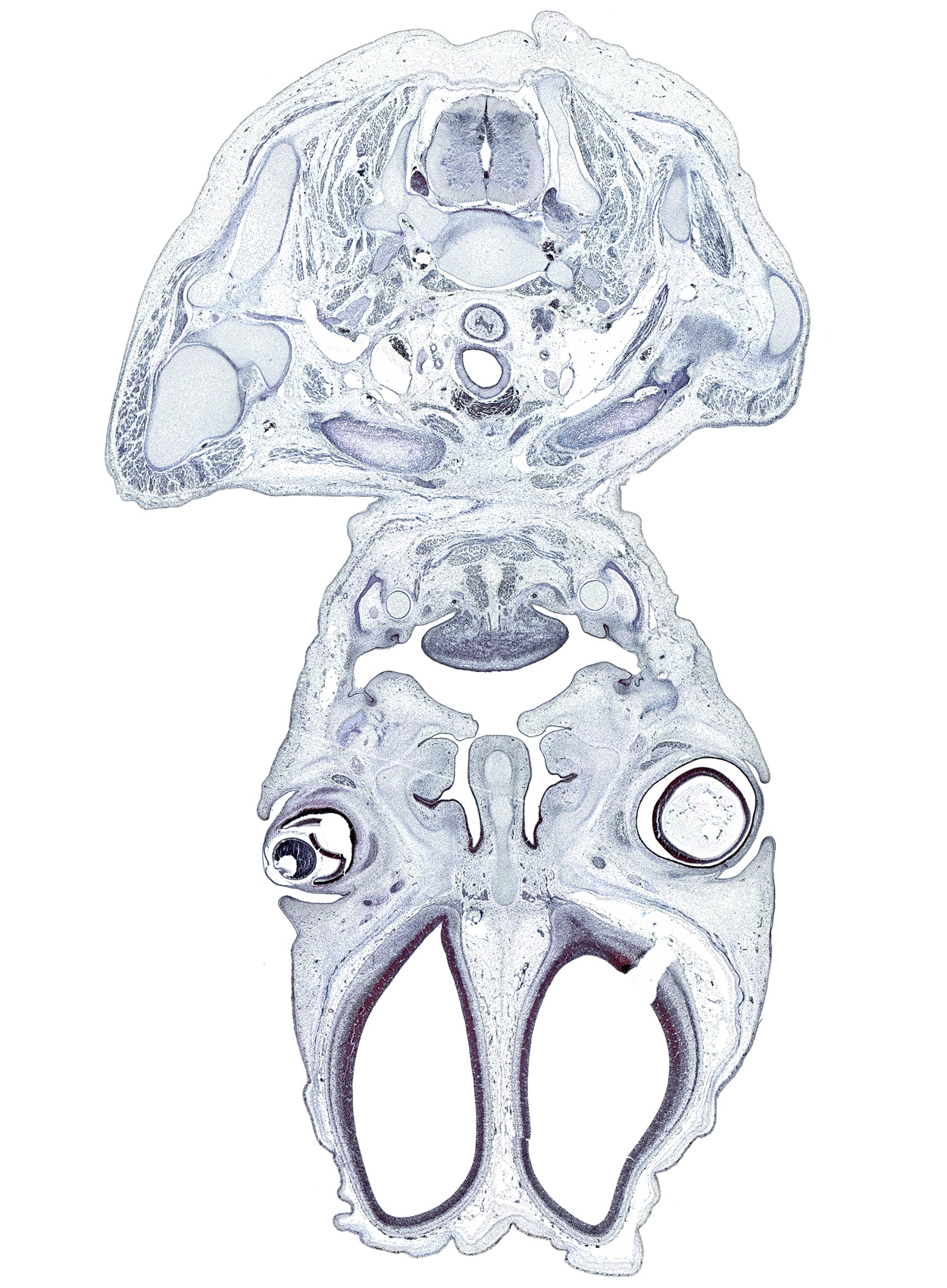 C-7 spinal ganglion, anterior belly of digastric muscle, artifact(s), clavicle, common carotid artery, coracoid process of scapula, cornea, crista galli, deltoid muscle, falx cerebri region, genioglossus muscle, geniohyoid muscle, head of humerus, hyaloid vessel(s), infraspinatus muscle, internal jugular vein, isthmus of thyroid gland, longus cervicis muscle, lower eyelid, mylohyoid muscle, olfactory ventricle, spine of scapula, upper eyelid, vagus nerve (CN X)