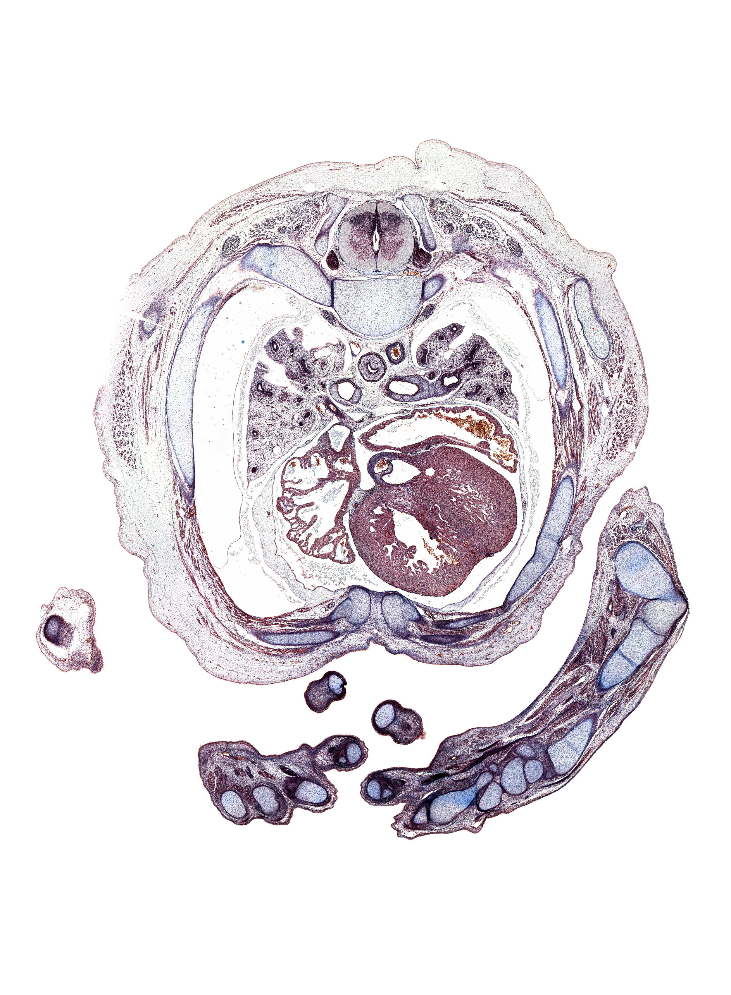 T-4 spinal ganglion, aortic vestibule, artifact(s), caudal edge of scapula, distal end of ulna, dorsal horn of grey matter, extensor compartment of forearm, flexor compartment of forearm, head of radius, humerus, lateral horn of grey matter, latissimus dorsi muscle, left digit 1 (thumb), loose mesenchyme, lower lobe of left lung, lumbrical muscle, metacarpal 3, musculi pectinati in right atrial wall, oblique fissure, primary bronchus, proximal interphalangeal joint of digit 2, right digit 1 (thumb), serratus anterior muscle, superior tertiary bronchus, thenar eminence, trabecular part of right ventricle, triceps brachii muscle, ventral horn of grey matter