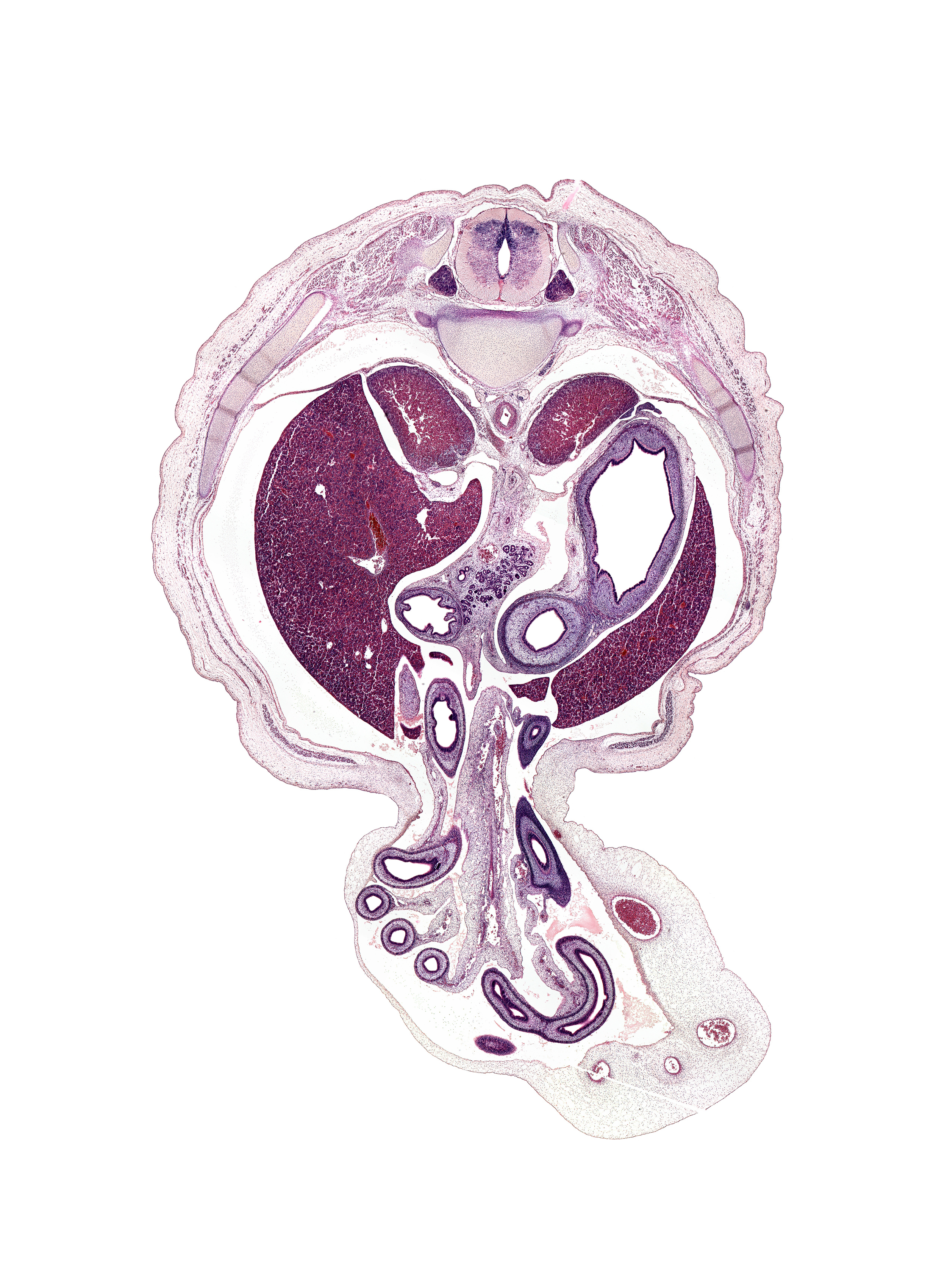 T-11 / T-12 intervertebral disc, T-11 spinal ganglion, allantois, body of pancreas, body of stomach, common bile duct, distal limb of herniated midgut, duodenum (second part), head of rib 12, hepatic portal vein, hindgut, inferior vena cava, left umbilical artery, muscular part of diaphragm, pleural cavity, proximal limb of herniated midgut, pylorus of stomach, rib 11, right umbilical artery, superior mesenteric artery, superior mesenteric vein, suprarenal gland cortex, umbilical vein