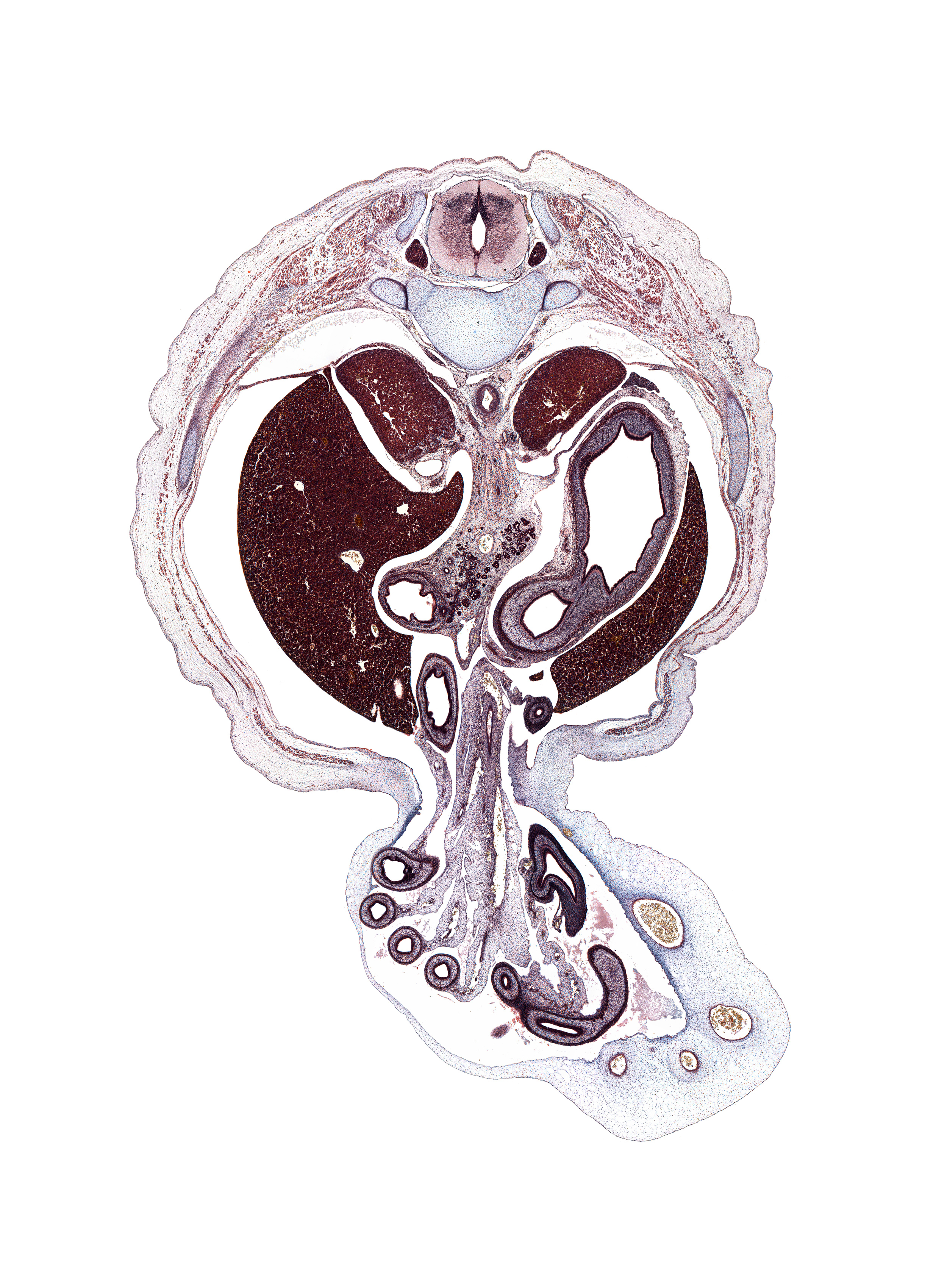 T-11 spinal ganglion, anterior rectus sheath, appendix, cecum, dorsal mesogastrium, external abdominal oblique muscle, head of rib 12, hindgut, internal abdominal oblique muscle, left lobe of liver, posterior rectus sheath, pyloric antrum of stomach, pyloric sphincter, rectus abdominis muscle, rib 11, spleen, superior mesenteric artery, transversus abdominis muscle, umbilical coelom