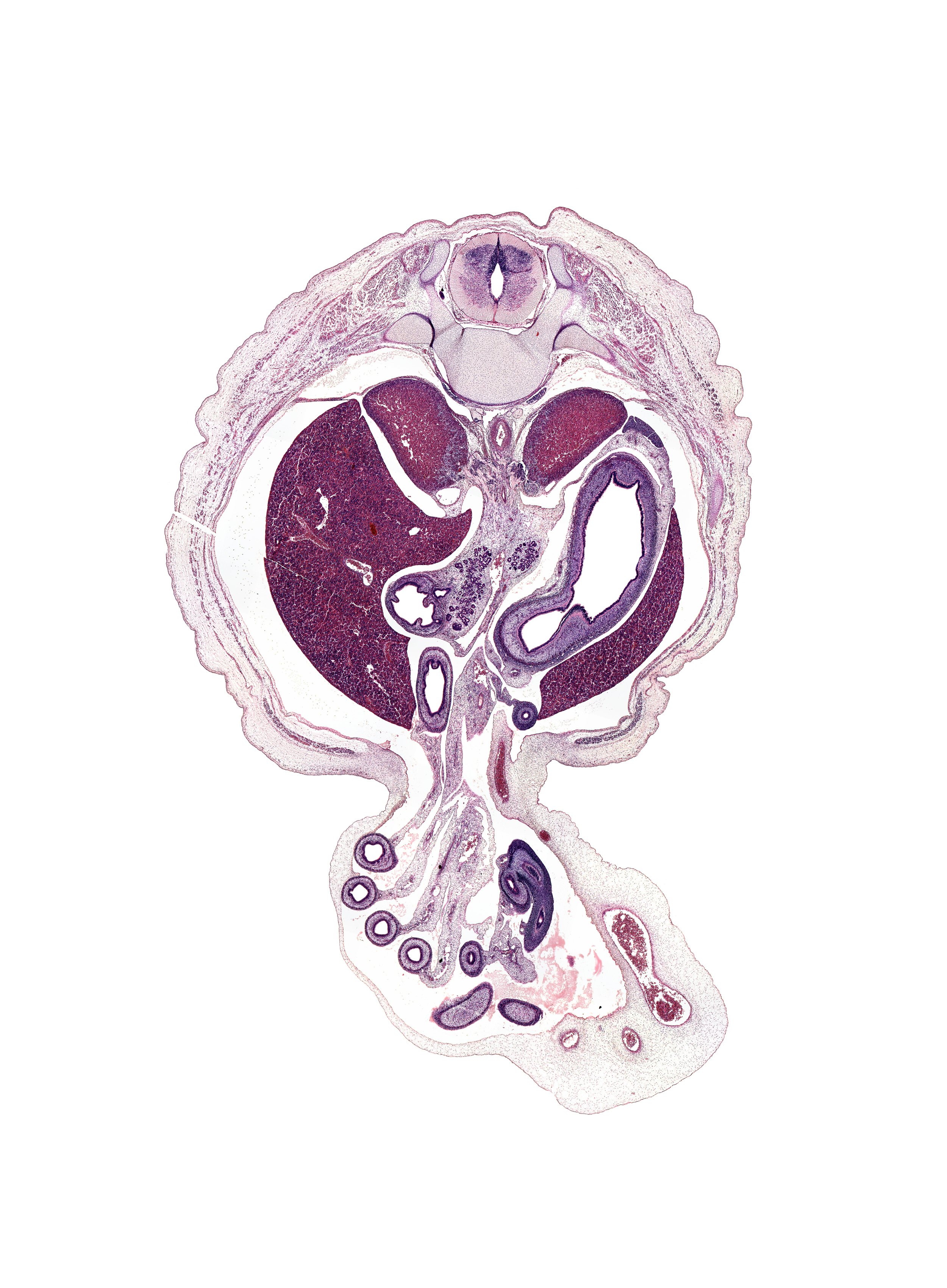 T-11 / T-12 interganglion region, allantois, aorta, appendix, artifact tear, body of stomach, celiac ganglion, distal limb of herniated midgut, duodenum (second part), hindgut, inferior vena cava, junction of common bile duct and duodenum, left umbilical artery, lesser sac (omental bursa), origin of celiac artery, proximal limb of herniated midgut, pyloric antrum of stomach, rib 12, right umbilical artery, spleen, superior mesenteric vein, suprarenal gland medulla, umbilical vein