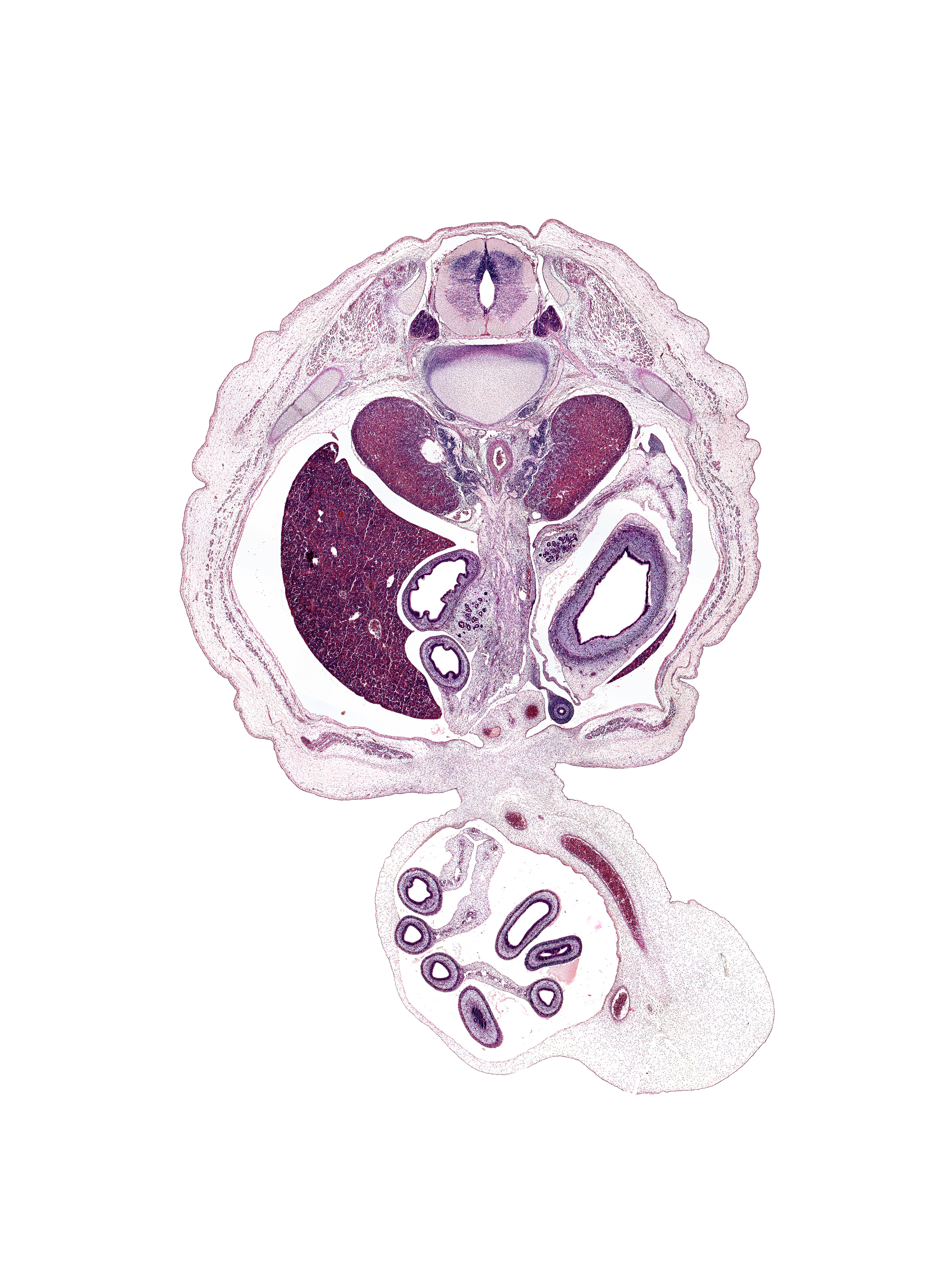 T-12 / L-1 intervertebral disc, T-12 dorsal primary ramus, T-12 spinal ganglion, T-12 spinal nerve, allantois, caudal edge of left lobe of liver, communicating ramus, distal limb of herniated midgut, dorsal fasciculus, duodenum (second part), duodenum (third part), head of pancreas, hindgut, inferior vena cava, lateral fasciculus, left umbilical artery, proximal limb of herniated midgut, rectus abdominis muscle, rib 12, right lobe of liver, right umbilical artery, splenic vein, subcostal nerve (T-12), superior mesenteric artery, suprarenal gland cortex, suprarenal gland medulla, sympathetic trunk, ventral fasciculus