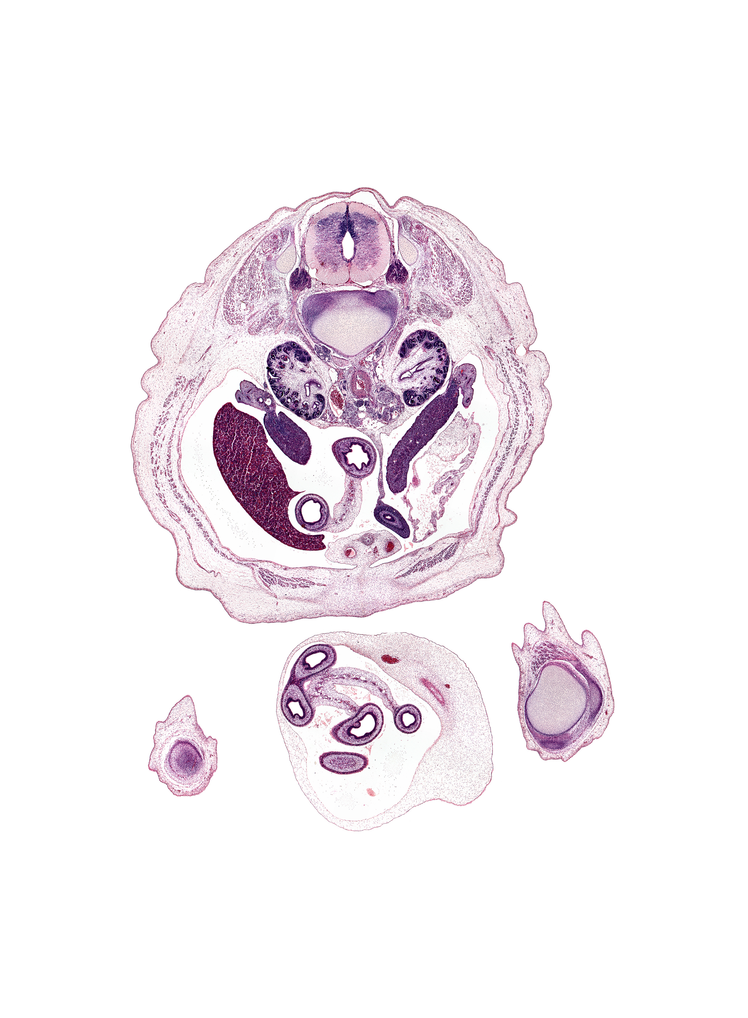 L-1 / L-2 intervertebral disc, L-1 spinal ganglion, aorta, apex of urinary bladder, caudal edge of right umbilical artery, central canal, dorsal horn of grey matter, edge of knee, hindgut, inferior vena cava, kidney cortex (metanephros), lateral horn of grey matter, left umbilical artery, lesser sac (omental bursa), major calyx, medial condyle of femur, patella, pelvis of kidney (metanephros), proximal limb of herniated midgut, quadriceps femoris tendon, right lobe of liver, testis, ureter, ventral horn of grey matter