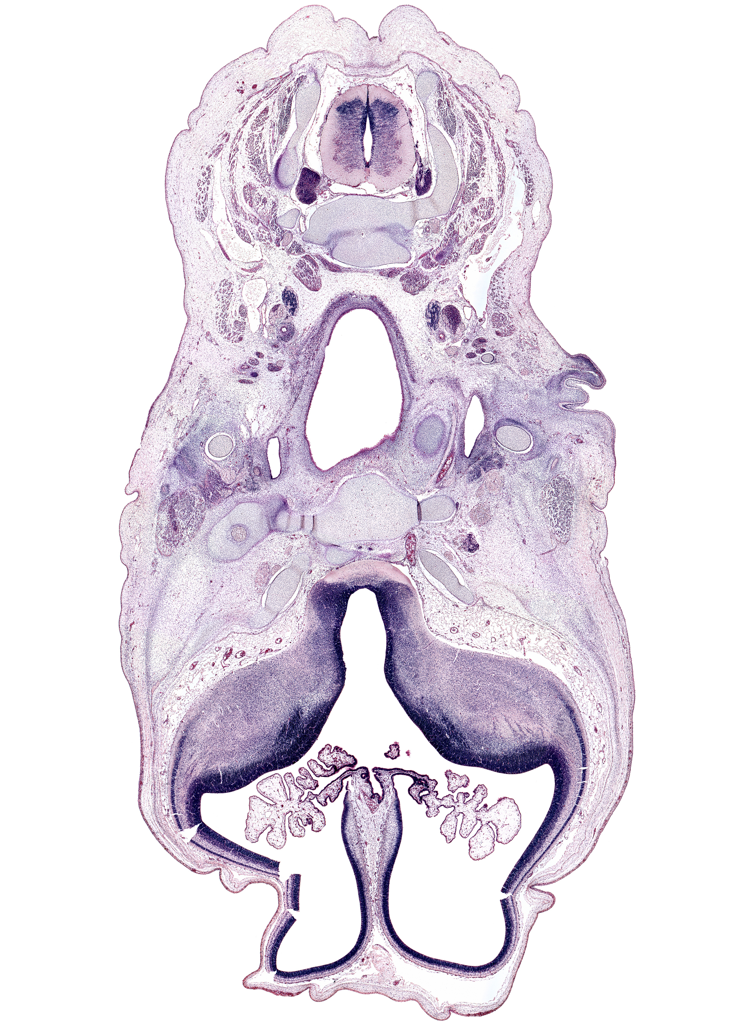 C-2 / C-3 intervertebral disc, C-3 spinal nerve, C-4 spinal ganglion, alisphenoid, auricle, centrum of C-3 vertebra, choroid plexus, corpus striatum, falx cerebri region, glossopharyngeal nerve (CN IX), internal carotid artery, interventricular foramen, lateral ventricle, lateral ventricular eminence (telencephalon), longus capitis muscle, mandibular nerve (CN V₃), maxillary nerve (CN V₂), medial ventricular eminence (diencephalon), ophthalmic nerve with ciliary ganglion (CN V₁), optic chiasma (chiasmatic plate), paraphysis, pharyngeal arch 1 cartilage (Meckel), pharyngotympanic tube, pharynx, retropharyngeal space, semispinalis capitis muscle, semispinalis cervicis muscle, sphenoid, splenius muscle, sternocleidomastoid muscle, subarachnoid space, superior pharyngeal constrictor muscle, third ventricle, trapezius muscle