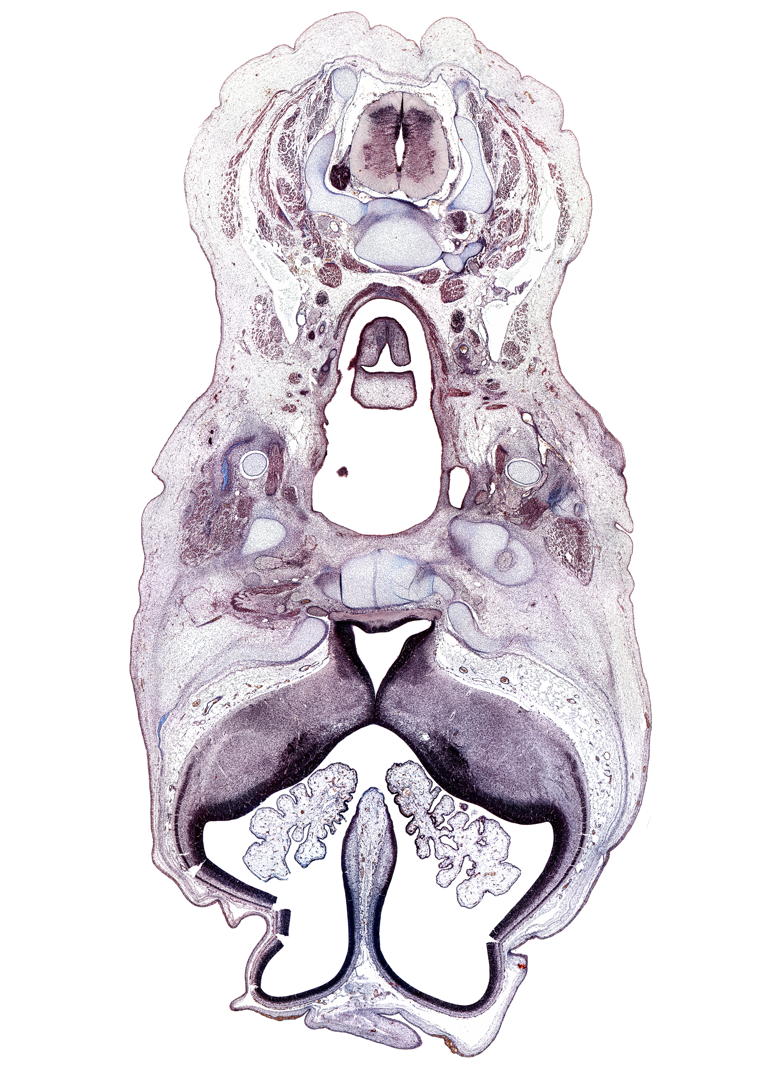 C-4 spinal ganglion, alisphenoid, choroid plexus, corpus striatum, external carotid artery, glossopharyngeal nerve (CN IX), hypothalamus, inferior alveolar nerve, internal carotid artery, jugular lymph sac, mandible, optic canal, optic chiasma (chiasmatic plate), optic nerve (CN II), orbitosphenoid, stylopharyngeus muscle, telencephalon medium, third ventricle, vertebral artery