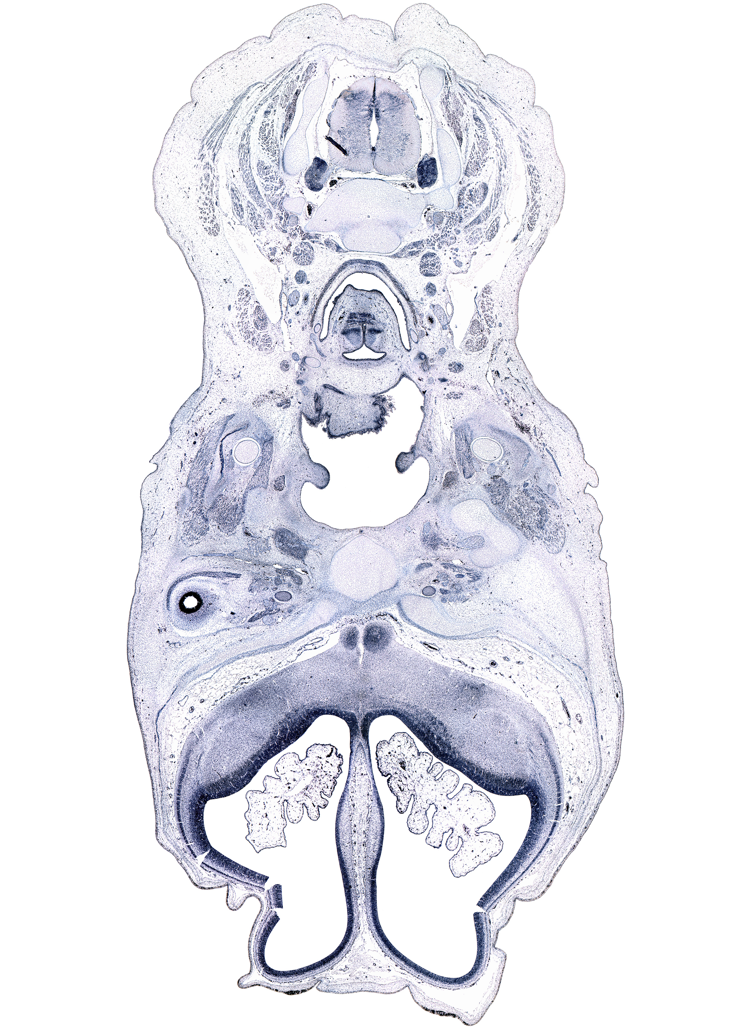 C-5 spinal ganglion, artifact(s), arytenoid swelling, cephalic edge of hypothalamus, ciliary ganglion, frontal nerve, glossopharyngeal nerve (CN IX), hippocampus, internal jugular vein, laryngeal pharynx, lateral rectus muscle, optic nerve (CN II), oropharynx, palatine shelf, posterior belly of digastric and stylohyoid muscles, sphenoid, sternocleidomastoid muscle, superior cervical sympathetic ganglion, trapezius muscle, vagus nerve (CN X)