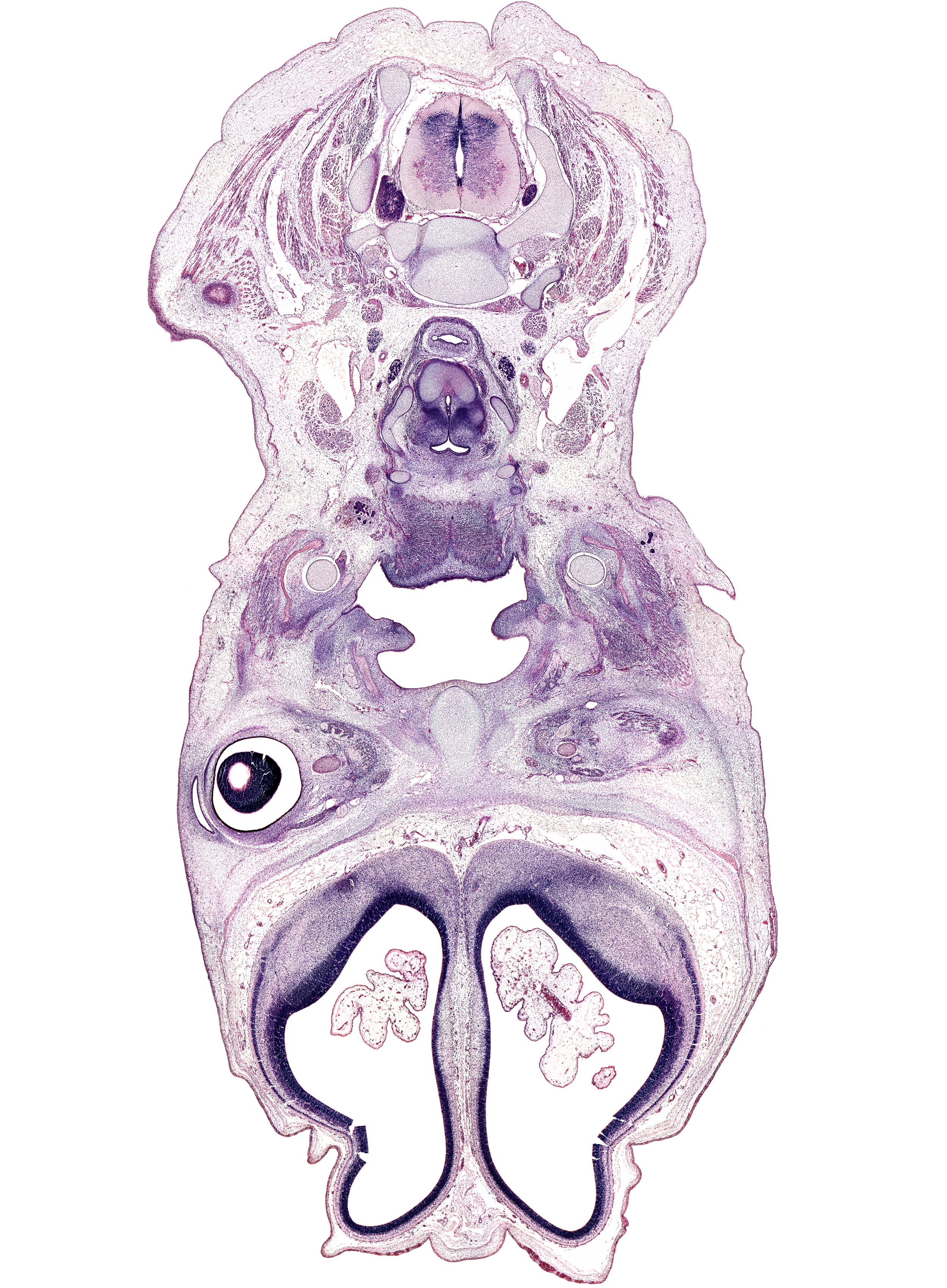 C-4 / C-5 intervertebral disc, C-5 spinal nerve, C-6 spinal ganglion, cerebral vesicle (hemisphere), common carotid artery, conjunctival sac, cortical plate, glossopharyngeal nerve (CN IX), horizontal palatine shelf, inferior pharyngeal constrictor muscle, internal jugular vein, intraretinal space (optic vesicle cavity), jugular lymph sac, masseter muscle, medial pterygoid muscle, neopallium, neural arch of C-5 vertebra, optic cup cavity, optic nerve (CN II), osteogenic layer, parotid gland, subarachnoid space, thyroid cartilage, ventricle of larynx