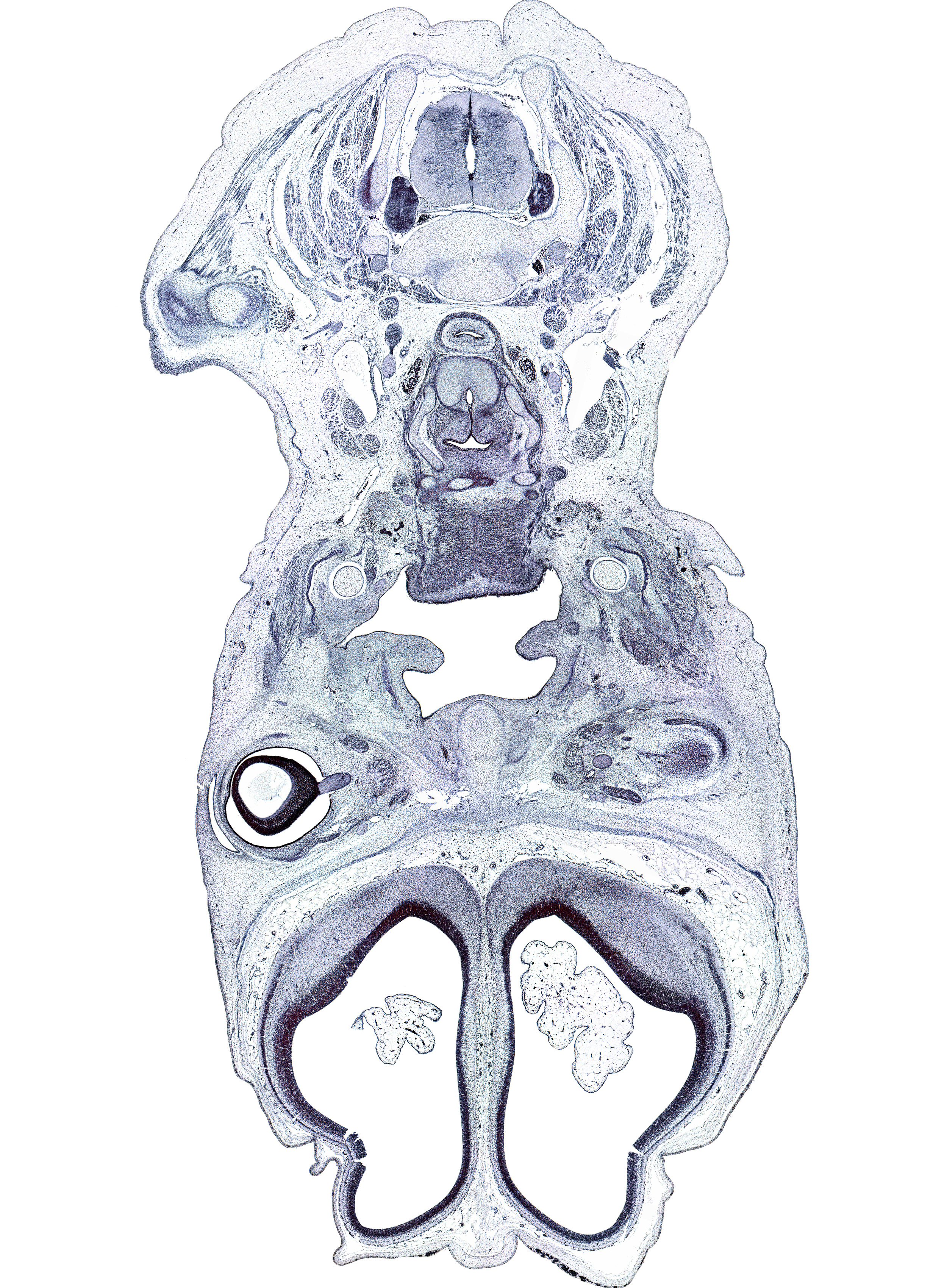 C-6 spinal ganglion, acromion process of scapula, artifact(s), clavicle, cortical plate, falx cerebri region, frontal prominence, hypoglossus muscle, jugular lymph sac, lateral part of conjunctival sac, nasal cavity (nasal sac), optic nerve (CN II), oral cavity, osteogenic layer, palatine shelf, parotid gland, sternocleidomastoid muscle, styloglossus muscle, stylohyoid muscle, subarachnoid space, submandibular ganglion, superior parathyroid gland, thyroid cartilage, trapezius muscle, vagus nerve (CN X)