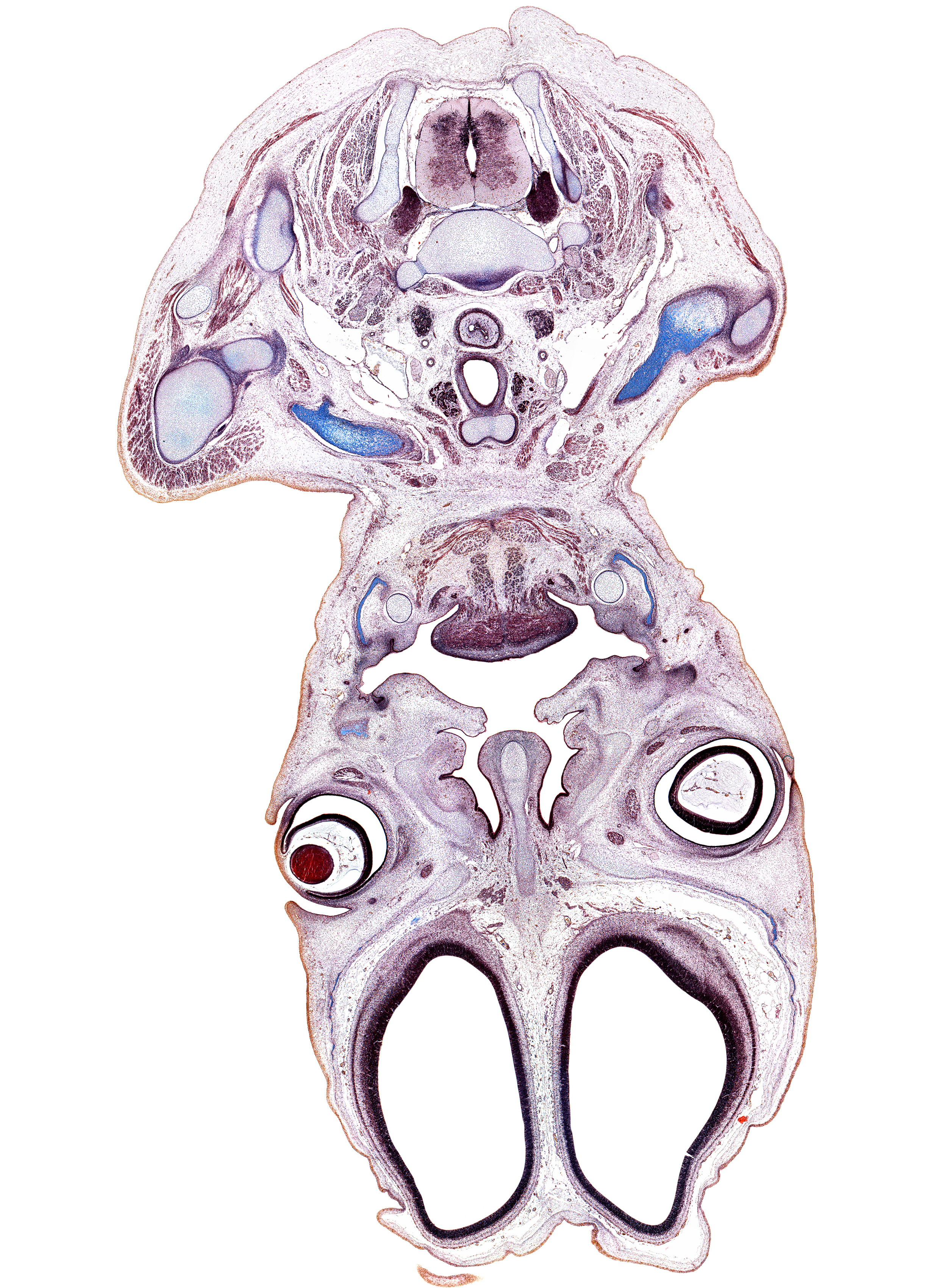 C-7 spinal ganglion, acromioclavicular joint, acromion process of scapula, cephalic edge of scapula, clavicle, conjunctival sac, cornea, crista galli, digastric tendon, inferior cervical sympathetic ganglion, inferior nasal concha, inferior parathyroid gland, lens, mandible, maxilla, middle nasal concha, olfactory bulb, osteogenic layer, platysma muscle, rhomboid minor muscle, scapula, sternocleidomastoid muscle, subarachnoid space, superior nasal concha