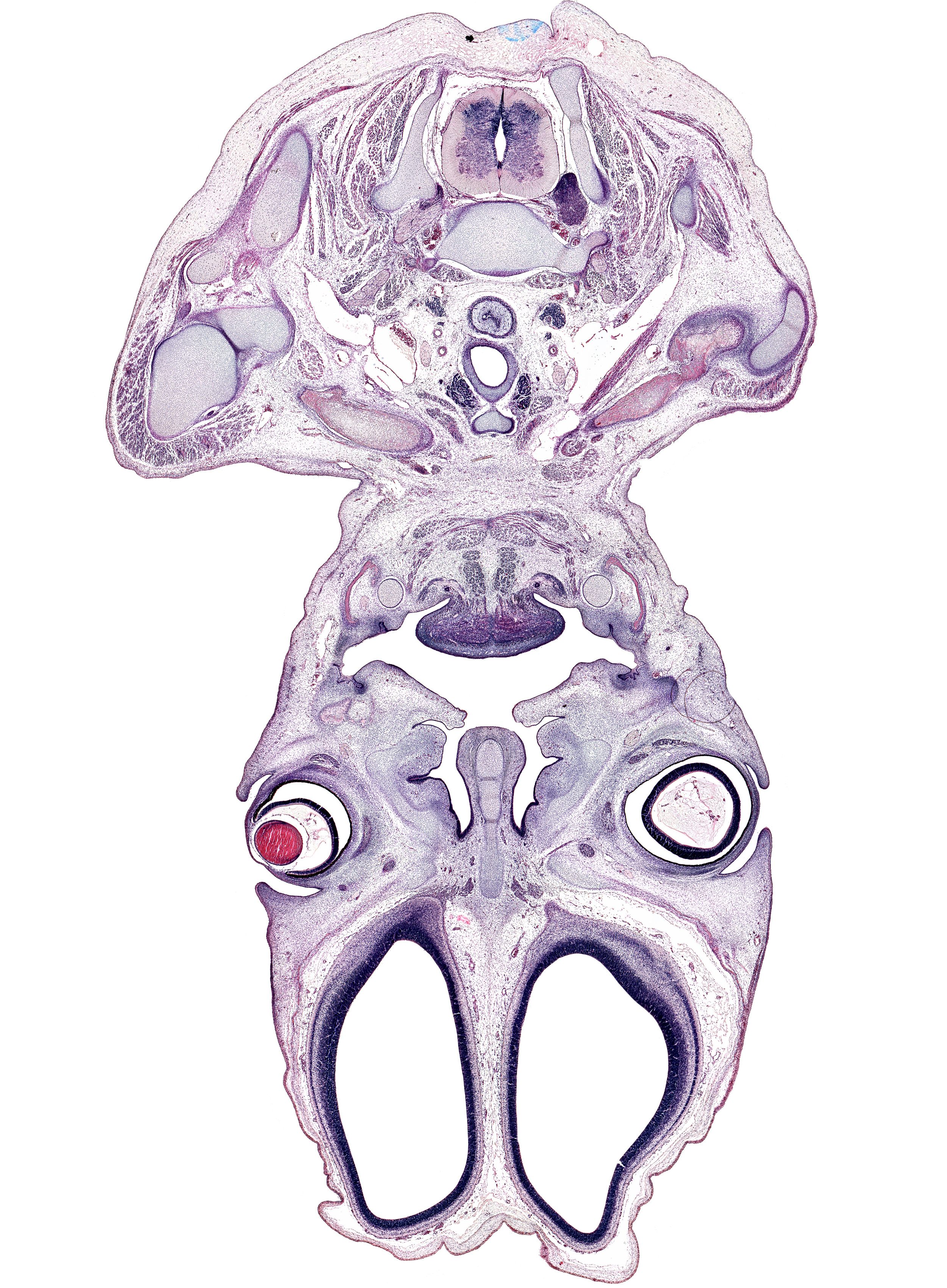 C-7 spinal ganglion, anterior belly of digastric muscle, anterior cerebral artery, centrum of C-6 vertebra, clavicle, cornea, cortical plate, falx cerebri region, geniohyoid muscle, hyaloid vessel(s), inferior nasal concha, inferior rectus muscle, intrinsic tongue muscles, lateral ventricle, left recurrent laryngeal nerve, levator scapulae muscle, longus cervicis and longus capitis muscles, lower eyelid, mandible, middle nasal concha, olfactory bulb, olfactory epithelium (placode), olfactory filia (CN I), palatine shelf, pharyngeal arch 1 cartilage (Meckel), platysma muscle, right common carotid artery, right subclavian artery, superior belly of omohyoid muscle, superior nasal concha, superior vena cava, thyroid gland, trapezius muscle, upper eyelid, vascular plexus