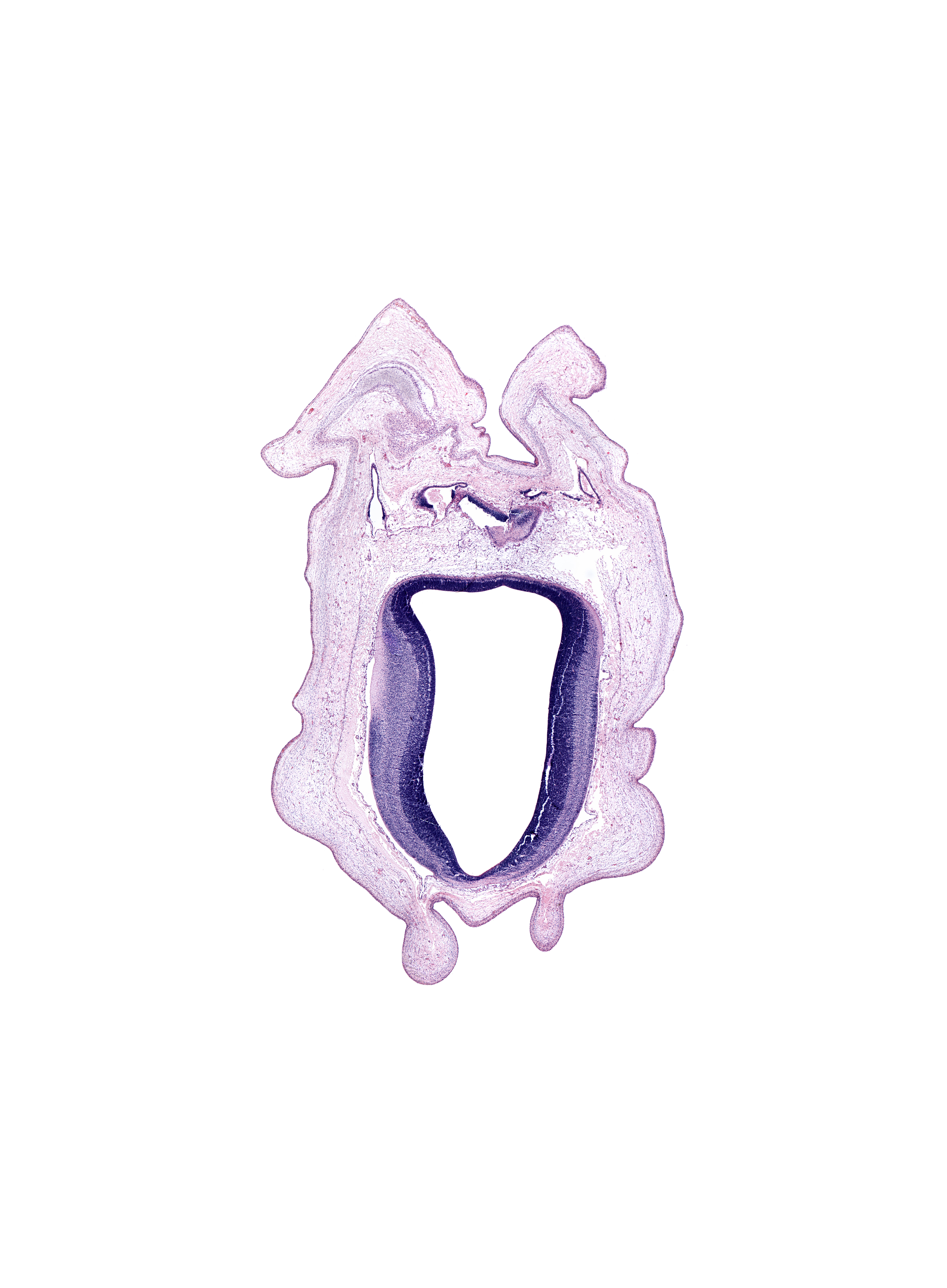 alar plate of mesencephalon, artifact(s), commissure of superior colliculus, intermediate zone, marginal zone, roof plate of mesencephalon, ventricular zone