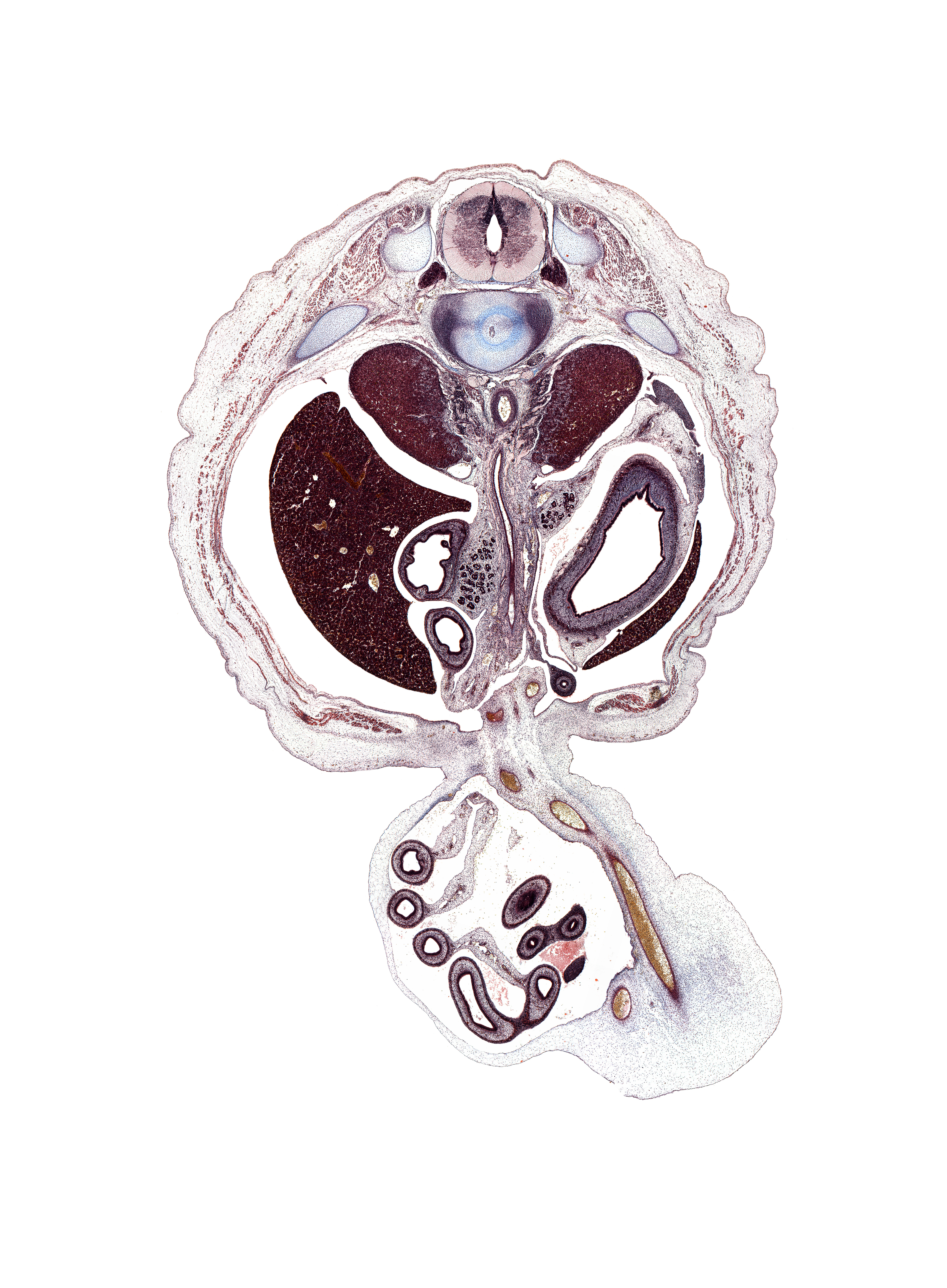 T-12 / L-1 intervertebral disc, T-12 spinal ganglion, body of pancreas, caudal edge of appendix, distal limb of herniated midgut, dorsal horn of grey matter, dura mater, lateral horn of grey matter, left crus of diaphragm, left lobe of liver, lesser sac (omental bursa), mesentery, proximal limb of herniated midgut, rib 12, right crus of diaphragm, right lobe of liver, spleen, subarachnoid space, suprarenal gland medulla, umbilical coelom, ventral horn of grey matter