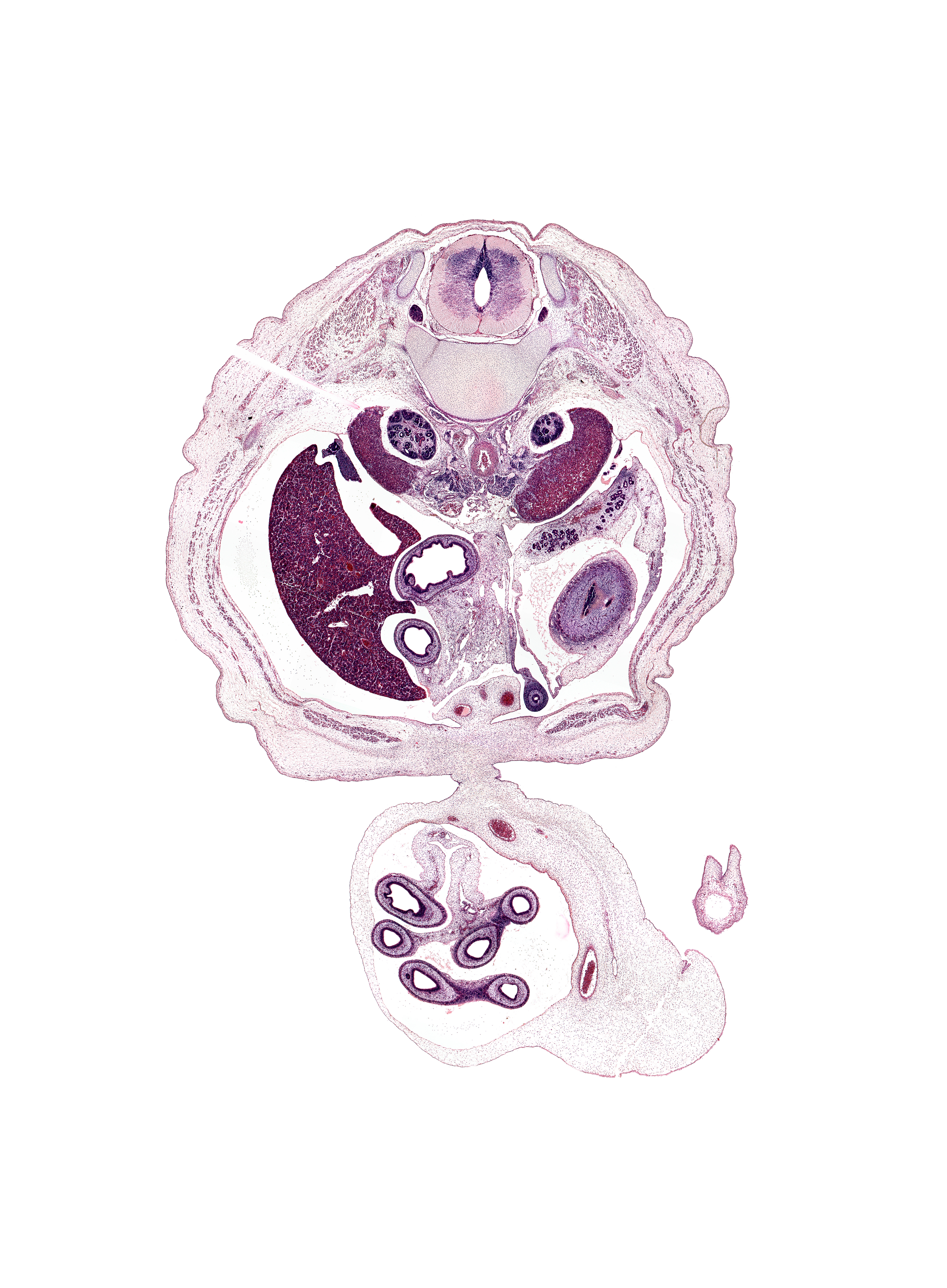 T-12 spinal ganglion, allantois, amnion on surface of umbilical cord, aorta, artifact(s), body of pancreas, central canal, cephalic edge of kidney (metanephros), cephalic edge of left knee, duodenum (third part), external abdominal oblique muscle, internal abdominal oblique muscle, left umbilical artery, lesser sac (omental bursa), mesentery, mesonephros, muscularis of stomach, neural arch, proximal limb of herniated midgut, right lobe of liver, right umbilical artery, subcostal nerve (T-12), superior mesenteric ganglion, suprarenal gland cortex, transversus abdominis muscle