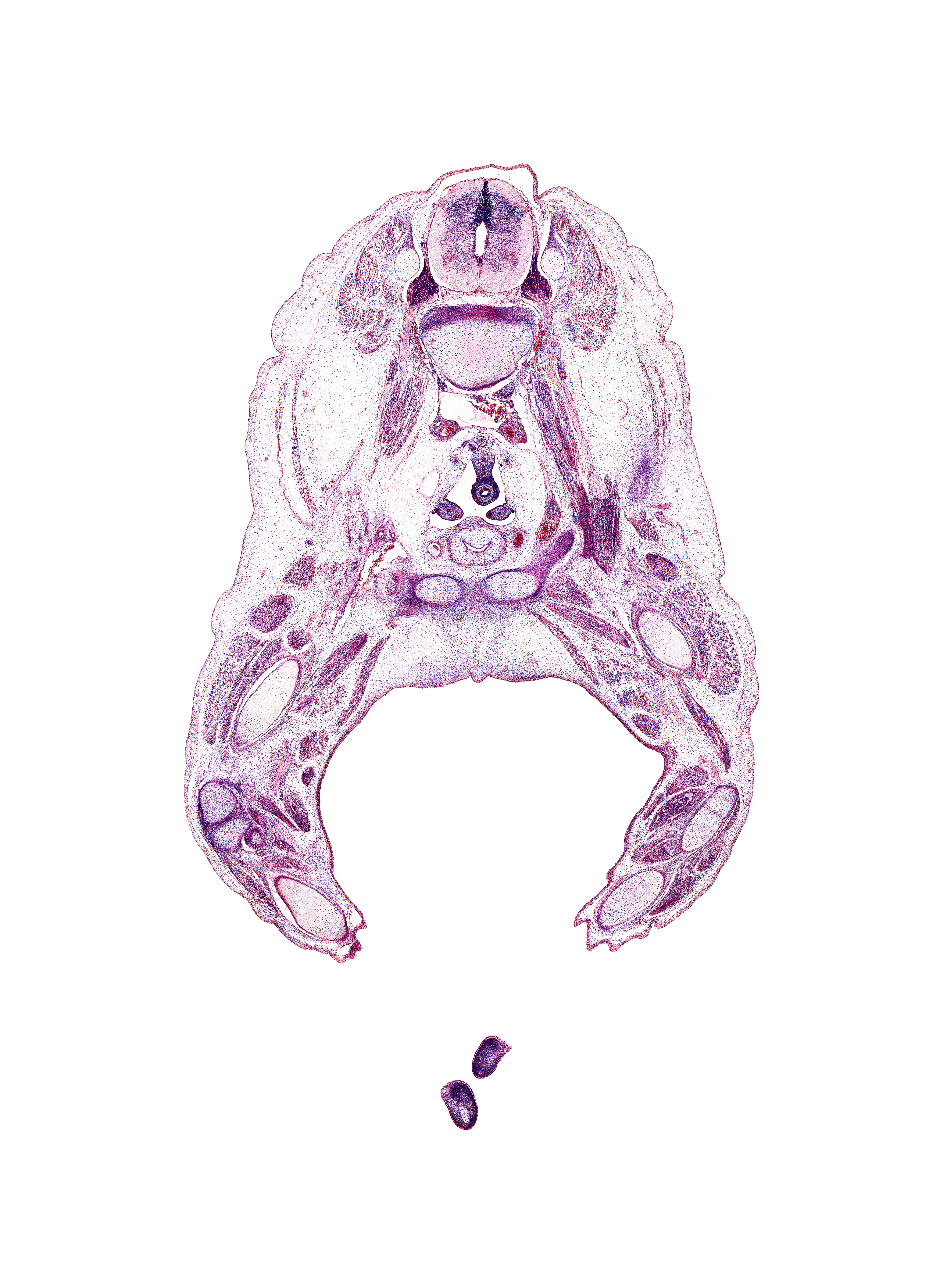 L-3 / L-4 intervertebral disc, L-3 spinal ganglion, adductor longus muscle, body of pubis, common fibular nerve, edge of digit 1 (foot), fibula, gracilis muscle, head of fibula, iliacus muscle, lateral condyle of tibia, left common iliac artery, medial head of gastrocnemius muscle, mesonephric duct, paramesonephric duct, plantaris muscle, psoas major muscle, rectum, right common iliac artery, symphysis of pubis, tibia, tibial nerve, ureter