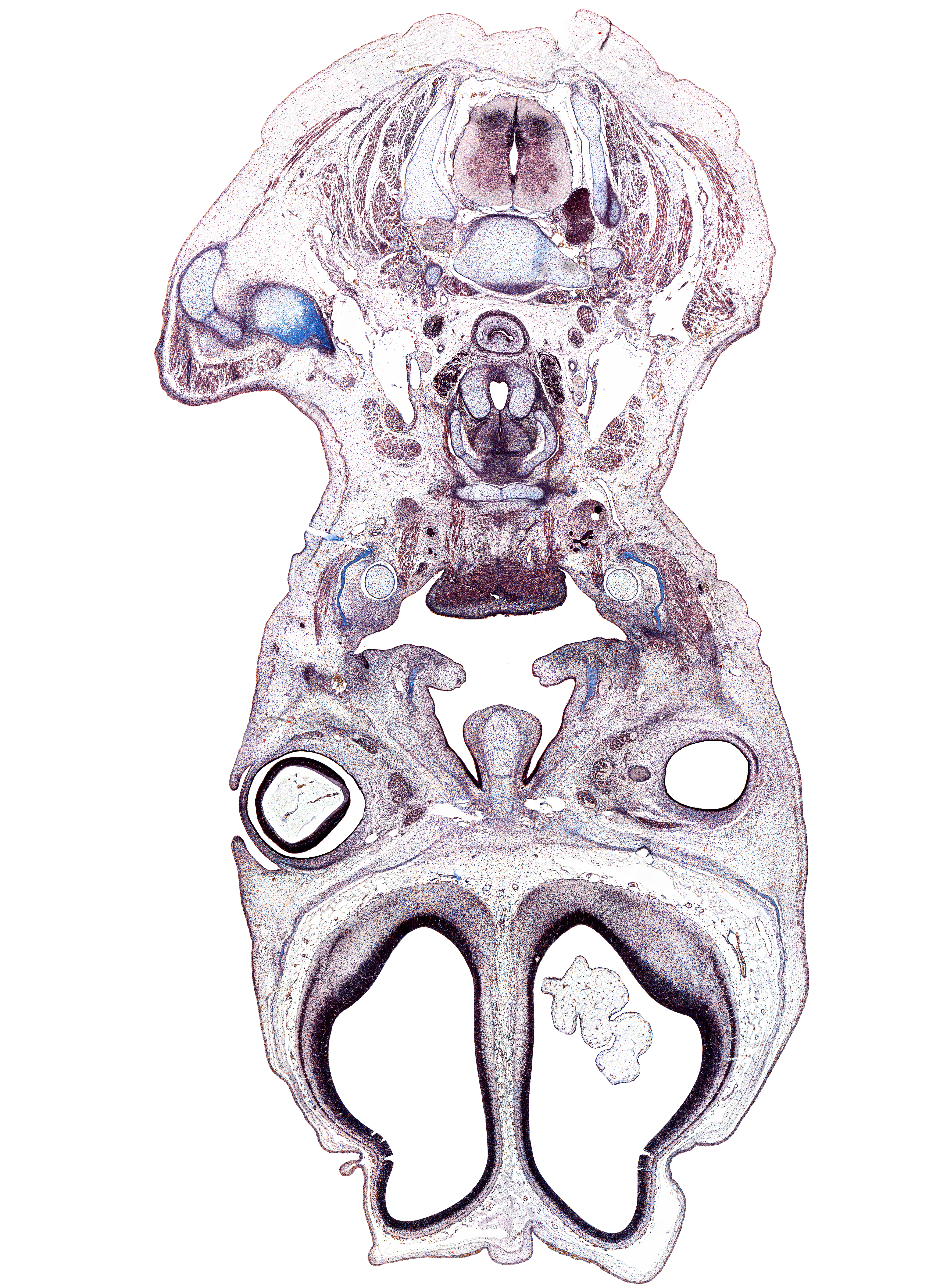 C-6 spinal ganglion, acromioclavicular joint, acromion process of scapula, artifact(s), clavicle, deltoid muscle, digastric tendon, frontal prominence, greater horn of hyoid (pharyngeal arch 3 cartilage), inferior oblique muscle, inferior rectus muscle, intraretinal space (optic vesicle cavity), jugular lymph sac, levator scapulae muscle, mandible, masseter muscle, osteogenic layer, palatine bone, parotid duct, platysma muscle, subarachnoid space, thyroid gland, trapezius muscle