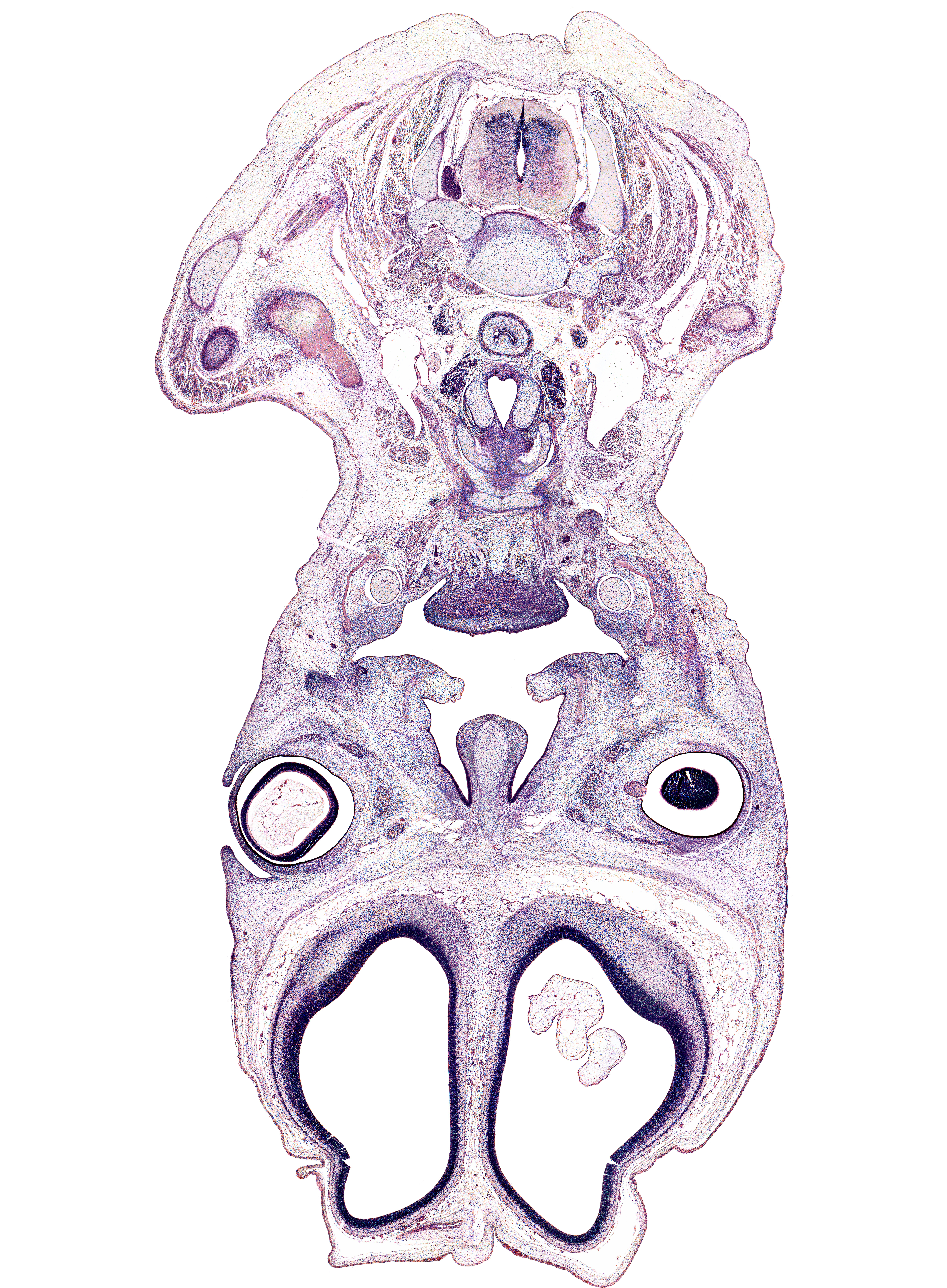 C-5 / C-6 intervertebral disc, C-6 spinal ganglion, C-6 spinal nerve, body of hyoid (pharyngeal arch 3 cartilage), cerebral vesicle (hemisphere), choroid plexus, common carotid artery, cortical plate, cricoid cartilage, dorsal horn of grey matter, extrinsic ocular muscle(s), grey matter, hypoglossal nerve (CN XII), hypoglossus muscle, internal jugular vein, mandible, masseter muscle, middle cervical sympathetic ganglion, nasal septal cartilage, optic nerve (CN II), sternocleidomastoid muscle, superior ophthalmic vein, thyroid cartilage, thyroid gland, tooth bud(s), transverse process, vagus nerve (CN X), ventral horn of grey matter, white matter