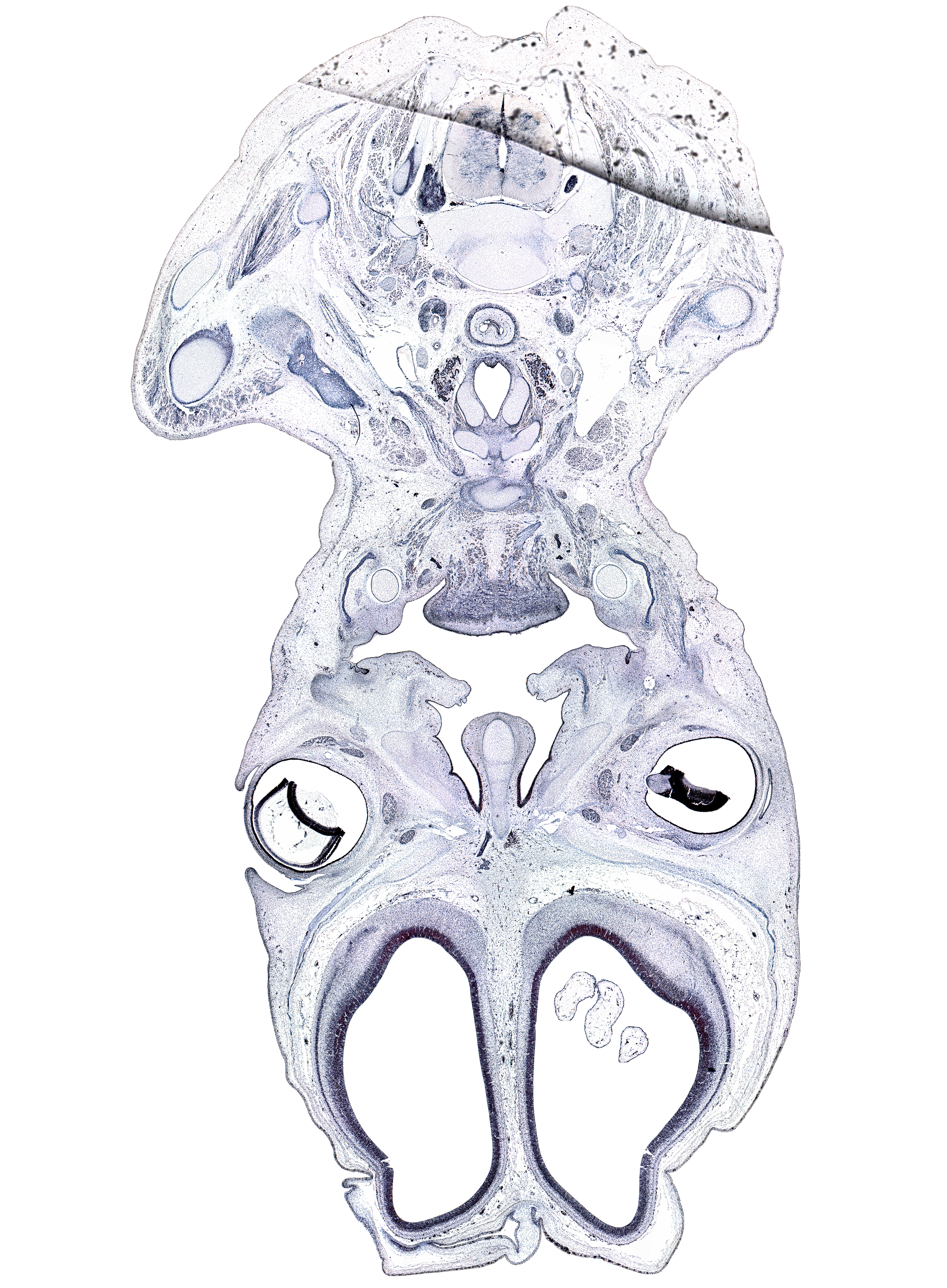 C-7 spinal ganglion, acromion process of scapula, artifact(s), cerebral vesicle (hemisphere), clavicle, common carotid artery, cortical plate, deltoid muscle, digastric tendon, esophagus, horizontal layer of intrinsic muscles of tongue, humerus, hypoglossal nerve (CN XII), lateral ventricle, levator palprebae superioris muscle, mylohyoid muscle, nasal cavity (nasal sac), palatine shelf, scapula, sternocleidomastoid muscle, superior rectus muscle, thyroid gland, trapezius muscle, vagus nerve (CN X)