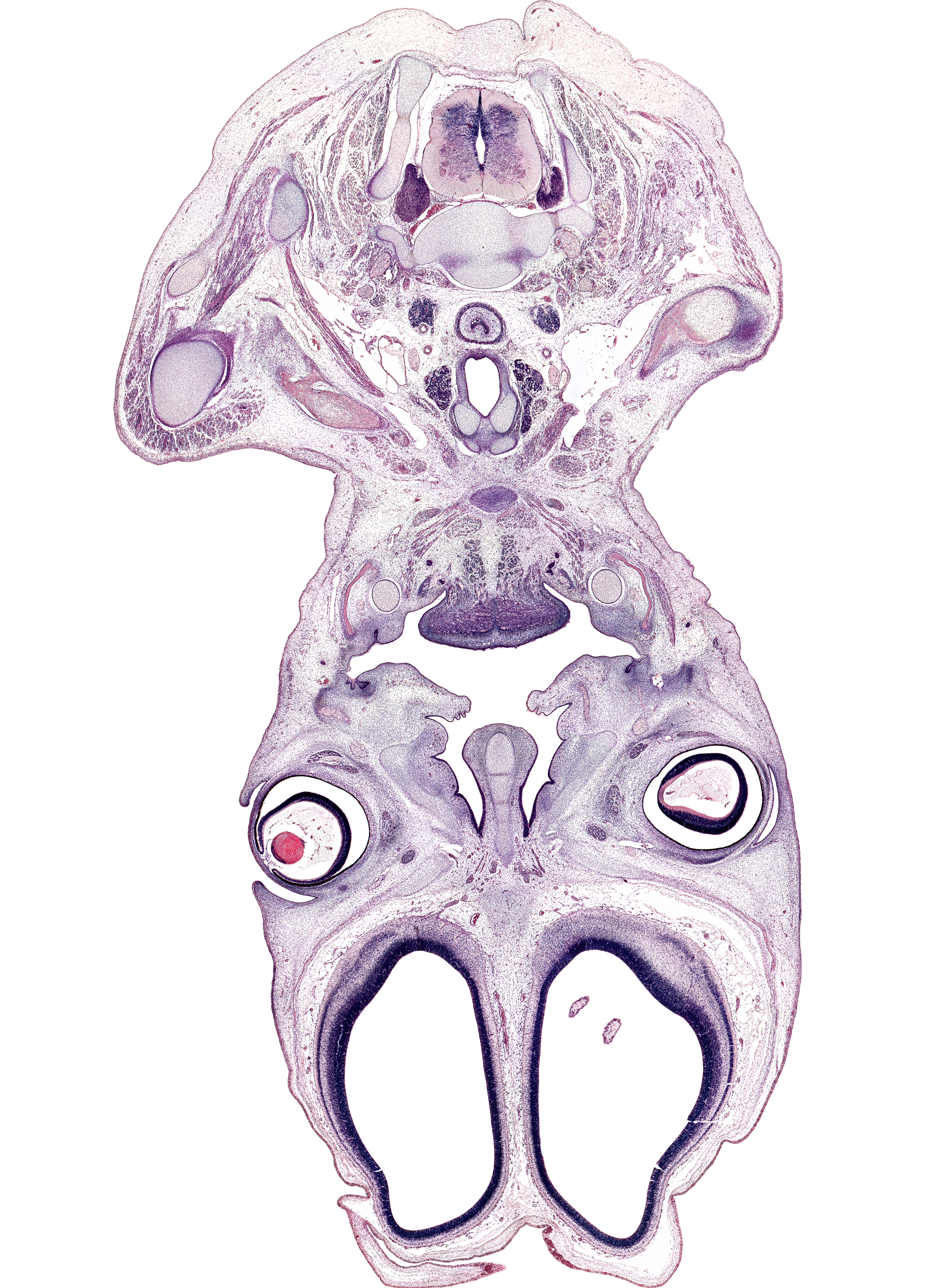 C-5 / C-6 intervertebral disc, C-6 spinal nerve, C-7 spinal ganglion, acromion process of scapula, body of hyoid (pharyngeal arch 3 cartilage), cerebral vesicle (hemisphere), common carotid artery, conjunctival sac, esophagus muscularis, extrinsic ocular muscle(s), genioglossus muscle, geniohyoid muscle, head of humerus, horizontal layer of intrinsic muscles of tongue, inferior alveolar nerve, lateral ventricle, lens, mandible, mylohyoid muscle, nasal septal cartilage, neural layer of retina, olfactory epithelium (placode), olfactory filia (CN I), palatal process of maxilla, palatine shelf, pharyngeal arch 1 cartilage (Meckel), pigmented layer of retina, rim of optic cup, scleral condensation, sternocleidomastoid muscle, superior belly of omohyoid muscle, supraspinatus muscle, tendon of subscapularis muscle, thyroid gland, trapezius muscle, vitreous body