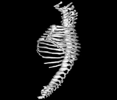 Axial Skeleton