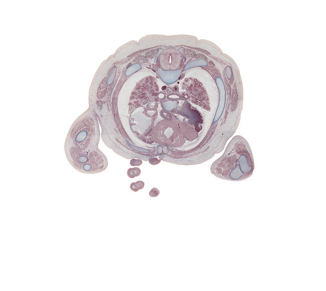 T-4 spinal ganglion, anterior atrioventricular sulcus, aorta, aortic semilunar valve, ascending aorta, azygos vein, central canal, cephalic edge of right ventricle, esophagus, humero-ulnar joint, humerus, left atrium, left primary bronchus, neural arch, pectoralis major muscle, pericardial sac, rib 4, rib 5, right atrium, right primary bronchus, right ventricle, scapula, spinal cord, superior hemi-azygos vein, superior vena cava, sympathetic trunk, transverse pericardial sinus, triceps brachii muscle, upper lobe of left lung, upper lobe of right lung