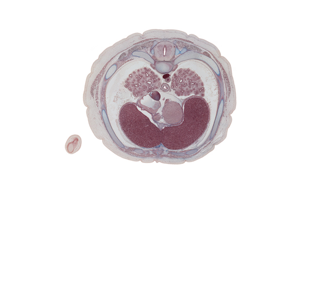 T-6 / T-7 interganglion region, anastomosis between azygos and hemi-azygos veins, aorta, caudal edge of right ventricle, costodiaphragmatic recess, esophagus, inferior vena cava, interventricular sulcus, left lobe of liver, left vagus nerve (CN X), left ventricle, lower lobe of right lung, oblique sinus of pericardial cavity, pericardial sac, rib 7, rib 7 (costal cartilage), right atrium, right elbow, right lobe of liver, right vagus nerve (CN X)