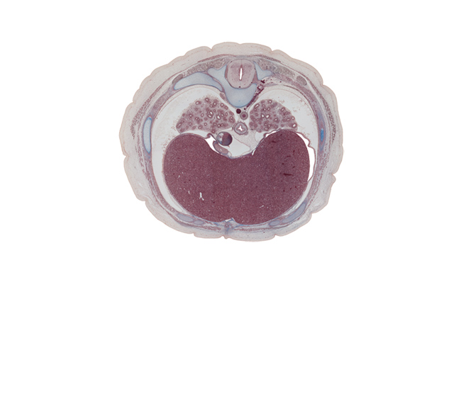 T-7 spinal ganglion, aorta, caudal edge of right atrium, costal margin, diaphragm, esophageal nerve plexus, greater splanchnic ramus, inferior vena cava, left lobe of liver, linea alba, pericardial cavity, pleural cavity, rectus abdominis muscle, rib 7, right lobe of liver, sympathetic trunk