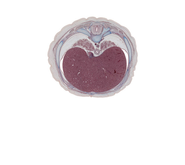 T-8 spinal ganglion, azygos vein, body of rib 8, dorsal funiculus, head of rib 8, inferior vena cava, lateral funiculus, left lobe of liver, lower lobe of left lung, lower lobe of right lung, neural arch, pedicle, pulmonary ligament, rib 8 (costal cartilage), right lobe of liver, sympathetic trunk, transverse process, trapezius muscle, ventral funiculus