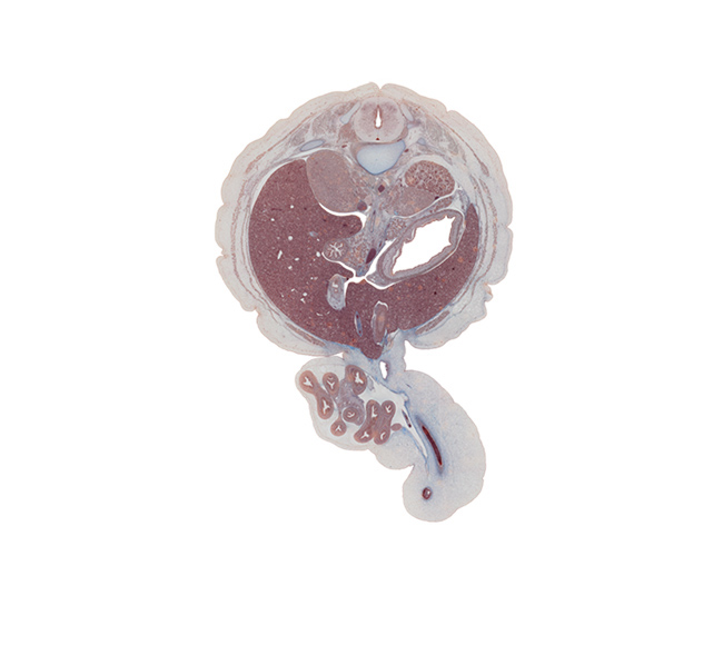 T-12 spinal ganglion, anterior spinal artery, aorta, body of dorsal pancreas, descending part of duodenum, edge of umbilical vein, gall bladder, greater curvature of stomach, head of ventral pancreas, herniated intestines, inferior vena cava, kidney (metanephros), left lobe of liver, left umbilical artery, lesser sac (omental bursa), peritoneal cavity, quadrate lobe of liver, rib 12, superior mesenteric artery, superior mesenteric vein, suprarenal gland, suprarenal gland cortex, sympathetic trunk, umbilical coelom, umbilical cord, umbilical vein, umbilical vesicle stalk