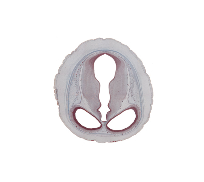 cerebral aqueduct (mesocoele), cerebral hemisphere (neopallium), collicular ridge (tectum), diencephalon, dorsal thalamus (caudal part), dural limiting membrane, ectomeninx, endomeninx, habenular region, hypothalamic sulcus, junction of cerebral aqueduct and third ventricle, lateral ventricle, mesencephalon, osteogenic layer, subarachnoid space, third ventricle