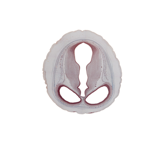 cerebral aqueduct (mesocoele), diencephalon, dorsal thalamus, hypothalamic sulcus, junction of cerebral aqueduct and third ventricle, lateral ventricle, mesencephalon (tectum), mesencephalon (tegmentum), sulcus dorsalis, third ventricle, venous plexus(es)