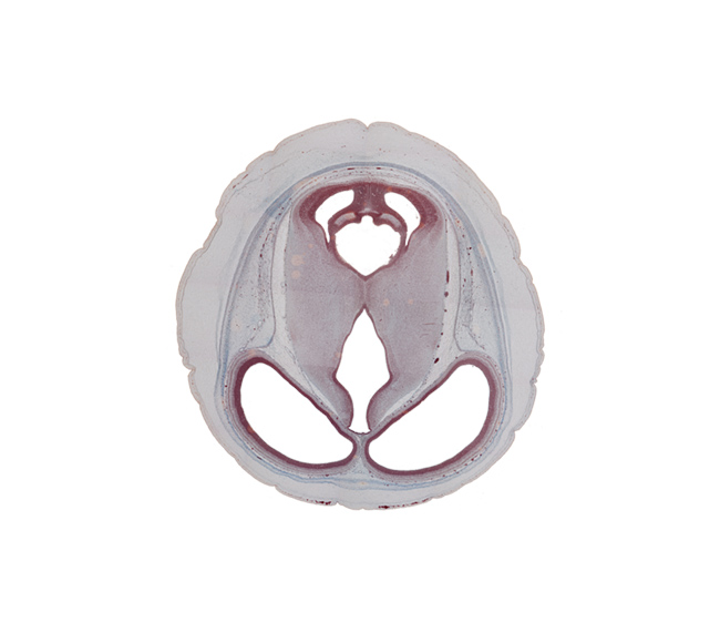 blind sack of cerebral aqueduct, cerebral aqueduct (mesocoele), cerebral hemisphere, diencephalon, dorsal thalamus, hypothalamic sulcus, inferior colliculus, lateral ventricle, mesencephalon (tectum), mesencephalon (tegmentum), sensory decussation, subarachnoid space, subcutaneous vascular plexus, sulcus dorsalis, third ventricle, vessels in pia mater