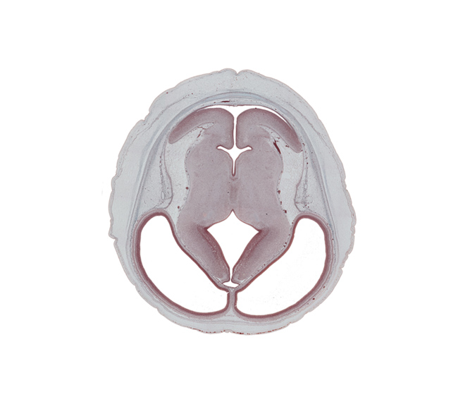 basis pedunculi of pons region (metencephalon), cerebral aqueduct (mesocoele), cerebral hemisphere (neopallium), cortical plate, diencephalic artery, dorsal thalamus, hypothalamic sulcus, intraventricular cerebellum, junction of cerebral aqueduct and rhombencoel (fourth ventricle), median sulcus, mesencephalic artery, rhombencoel (fourth ventricle), roof of third ventricle, sensory decussation, sulcus dorsalis, sulcus medius, superior cerebellar artery, trochlear nerve (CN IV), ventral thalamus