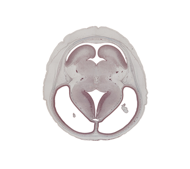 alar plate(s), basal plate, basis pedunculi of pons region (metencephalon), dorsal thalamus, edge of choroid plexus, hypothalamic sulcus, internal cerebellar swelling, interpeduncular fossa, median sulcus, membrane area of roof of rhombencoel (fourth ventricle), parietal lobe region of cerebral hemisphere, roof of third ventricle, sulcus dorsalis, sulcus limitans, supra-occipital cartilage, temporal lobe region of cerebral hemisphere, trochlear nerve (CN IV), ventral thalamus