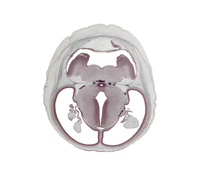 cephalic edge of medulla oblongata, choroid plexus, dorsal thalamus, hippocampus, hypothalamic sulcus, internal carotid artery, mamillary recess, oculomotor nerve (CN III), pons region (metencephalon), posterior cerebral artery, subarachnoid space, subcutaneous vascular plexus, sulcus dorsalis, terminal part of basilar artery, trochlear nerve (CN IV)