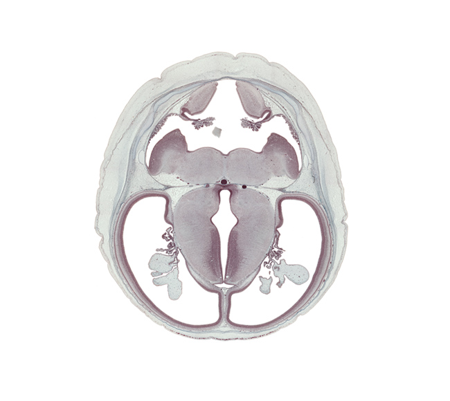 basilar artery, choroid fissure, choroid plexus, dorsal thalamus, external cerebellum, hippocampus, hypothalamic sulcus, hypothalamus, internal cerebellum, median aperture, oculomotor nerve (CN III), posterior communicating artery, rhombencoel (fourth ventricle), subthalamus, trochlear nerve (CN IV), ventral thalamus