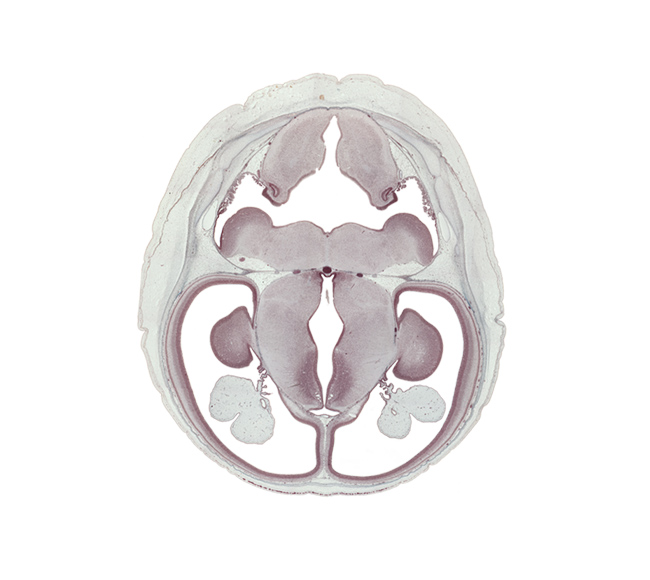 alar plate(s), basal plate, basis pedunculi of pons region (metencephalon), external cerebellum, falx cerebri region, fusion region with anterior choroidal artery, hypothalamic sulcus, hypothalamus, inferior sagittal sinus, internal capsule, internal cerebellum, median sulcus, medulla oblongata, parietal lobe region of cerebral hemisphere, roof of rhombencoel (fourth ventricle), roof plate, subthalamus, sulcus limitans, sulcus medius, superior sagittal sinus, tegmentum of pons, temporal lobe region of cerebral hemisphere, third ventricle