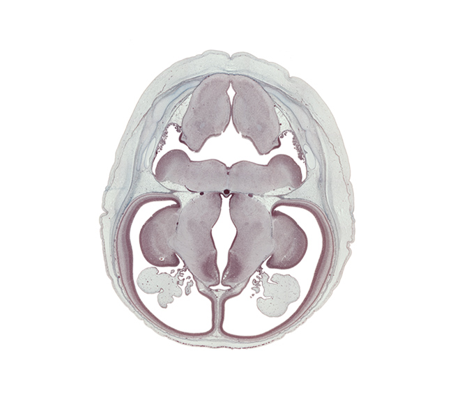 abducens nucleus, basilar artery, caudate nucleus, choroid plexus, dorsal thalamus, fusion region between cerebral vesicle and diencephalon, hypoglossal nucleus, hypothalamus, lateral ventricle, marginal ridge, medulla oblongata, obex, oculomotor nerve (CN III), pons region (metencephalon), rhombencoel (fourth ventricle), sensory decussation, spinal tract of trigeminal nerve (CN V), sulcus dorsalis, sulcus medius, third ventricle, trochlear nerve (CN IV), ventral thalamus