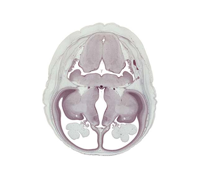 anterior inferior cerebellar artery, basilar artery, basis pedunculi of pons region (metencephalon), caudate nucleus, central canal, choroid fissure, choroid plexus, flocculus of cerebellum, hypothalamic sulcus, hypothalamus, insula of cerebral hemisphere, internal capsule, internal cerebellar swelling, medulla oblongata, posterior inferior cerebellar artery, rhombencoel (fourth ventricle), spinal tract of trigeminal nerve (CN V), temporal pole of cerebral hemisphere, third ventricle, transverse sinus, vascular plexus