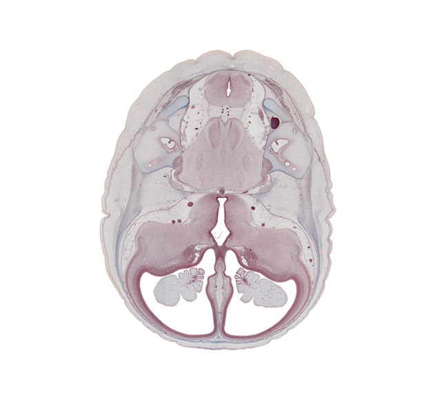 anterior inferior cerebellar artery, anterior semicircular duct, basilar artery, choroid plexus, facial nerve (CN VII), hippocampus, internal acoustic meatus, internal carotid artery, junction of common limb and utricle, lateral ventricle, oculomotor nerve (CN III), optic groove, optic tract, otic capsule, posterior inferior cerebellar artery, region of cervical flexure, root of trigeminal nerve (CN V), semispinalis capitis muscle, superior sagittal sinus, trochlear nerve (CN IV), vestibulocochlear nerve (CN VIII)