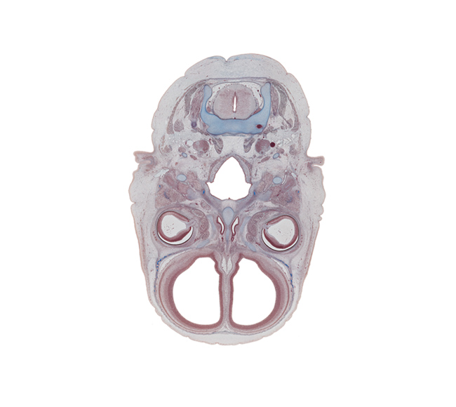 C-2 / C-3 interganglion region, blood vessels in vitreous body, centrum of C-2 vertebra (axis), ethmoid, extrinsic ocular muscle(s), falx cerebri region, glossopharyngeal nerve (CN IX), inferior ganglion of vagus nerve (CN X), intraretinal space (optic vesicle cavity), longus capitis muscle, nasal cavity (nasal sac), nasopharynx, neural arch of C-2 vertebra (axis), optic nerve (CN II), spinal accessory nerve (CN XI), splenius muscle, stylopharyngeus muscle, superior cervical sympathetic ganglion, trapezius muscle, vertebral artery