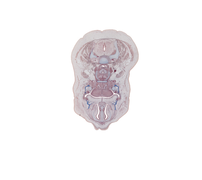 C-5 / C-6 intervertebral disc, C-6 spinal ganglion, body of hyoid (pharyngeal arch 3 cartilage), central canal, cricoid cartilage, hypoglossal nerve (CN XII), inferior nasal concha, laryngeal pharynx, mandible ossification, maxilla ossification, middle cervical sympathetic ganglion, nasal septum, palatine shelf, superior parathyroid gland, thyroid cartilage, vertebral artery in transverse foramen, vomeronasal duct