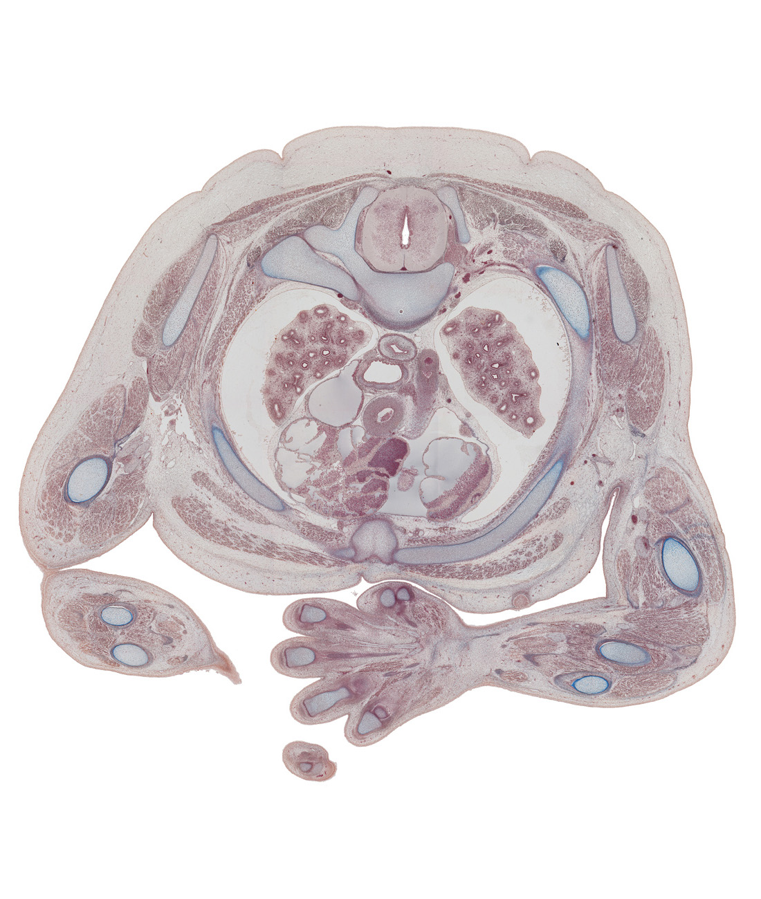 T-3 spinal ganglion, arch of azygos vein, ascending aorta, body of sternum, brachial artery, descending aorta, humerus, left atrium, left vagus nerve (CN X), mammary gland, neural arch of T-3 vertebra, pectoralis major muscle, pectoralis minor muscle, pleural cavity, posterior intercostal artery, proximal phalynx of digit 4 (ring finger), radius, rib 3, rib 3 (costal cartilage), right atrium, subcutaneous tissue, superior vena cava, surface ectoderm, transverse process of T-3 vertebra, ulna, upper lobe of left lung