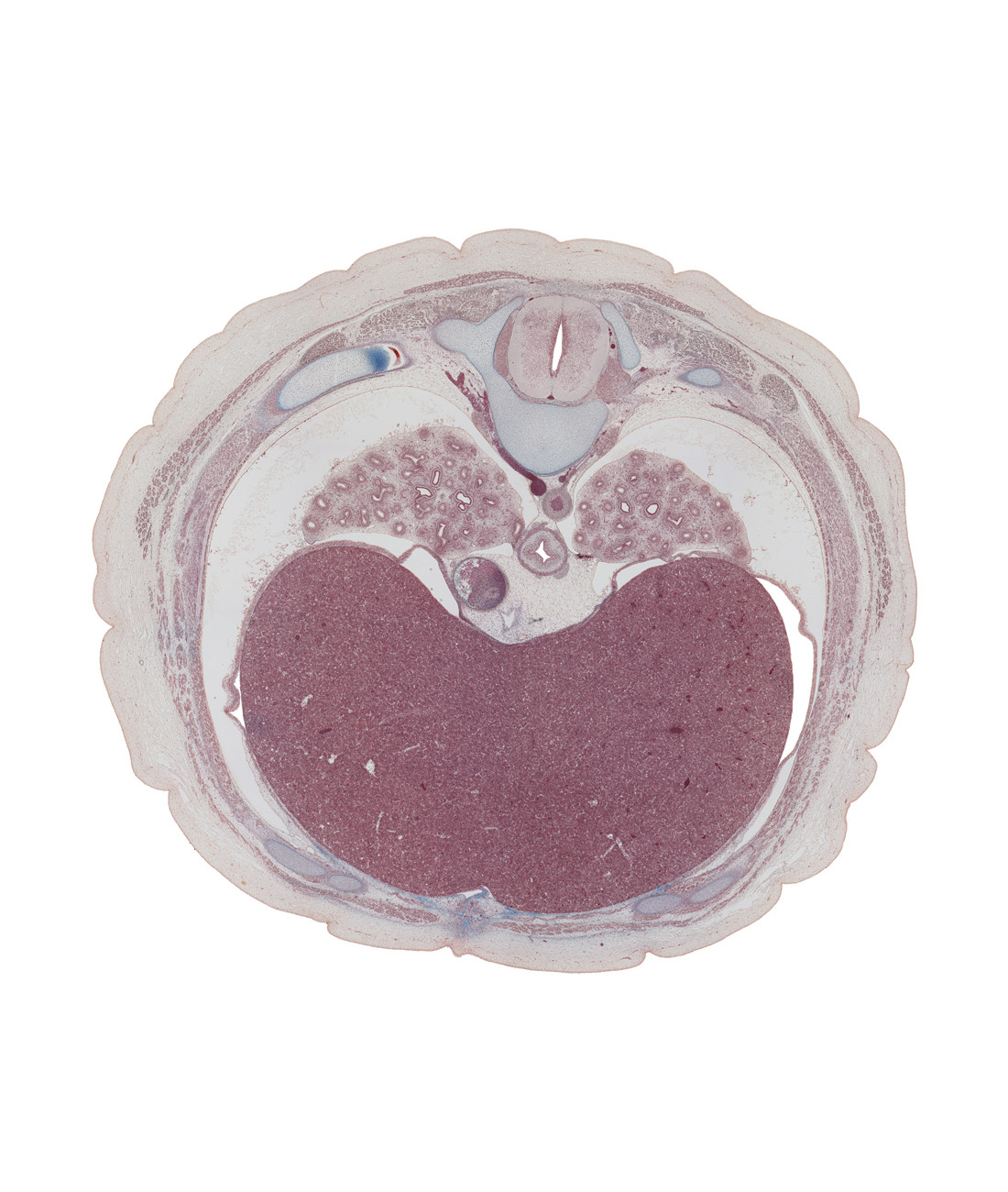 T-7 spinal ganglion, aorta, azygos vein, caudal part of pericardial cavity, central canal, central tendon of diaphragm, diaphragm, dorsal median septum, esophagus, inferior hemi-azygos vein, inferior vena cava, left lobe of liver, neural arch, posterior intercostal vein, right lobe of liver, spinal cord, transverse process, tubercle of rib 8