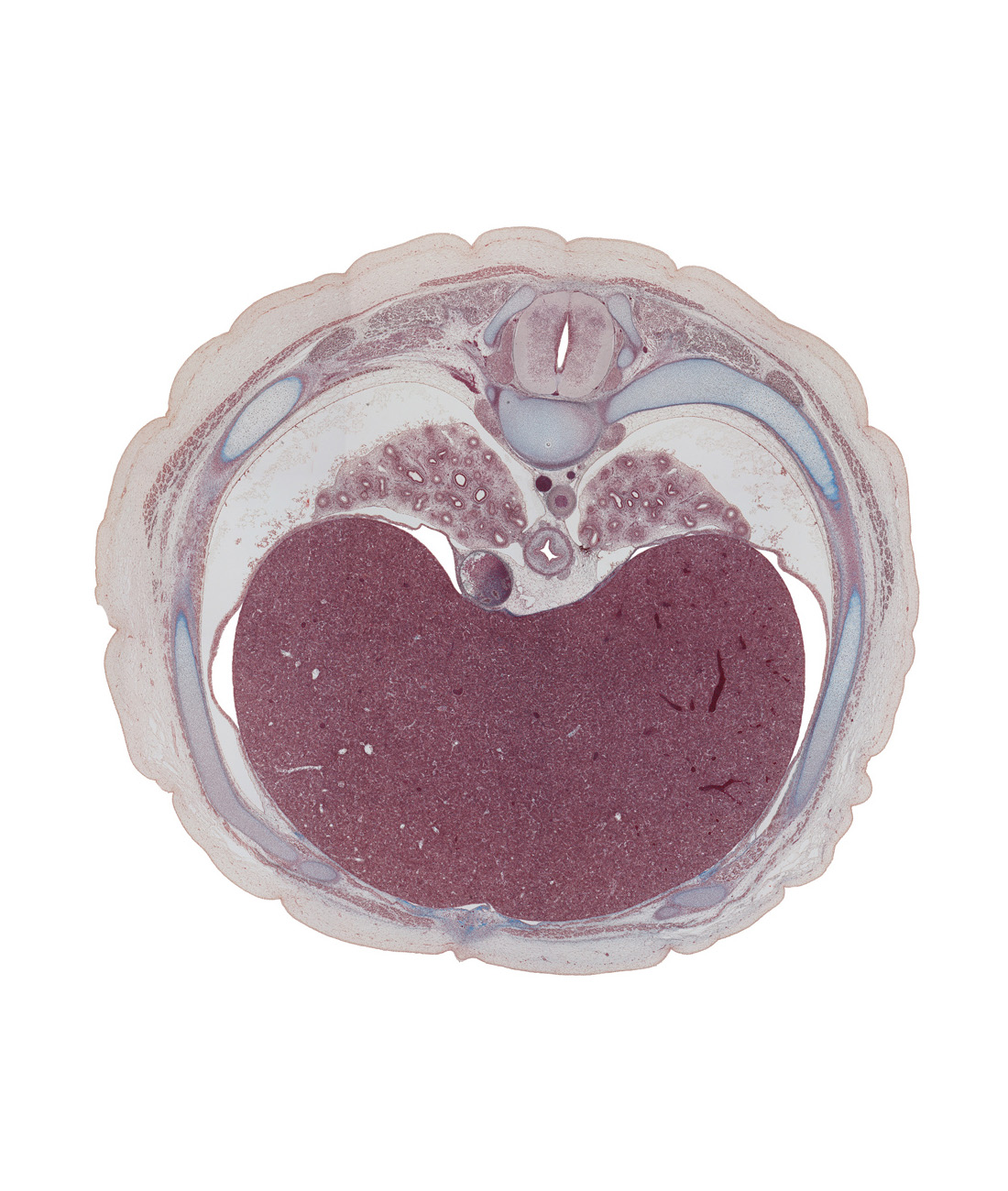 T-7 spinal ganglion, aorta, azygos vein, central canal, central tendon of diaphragm, costal margin, esophagus, inferior hemi-azygos vein, inferior vena cava, latissimus dorsi muscle, left lobe of liver, linea alba, rectus abdominis muscle, rib 8, right lobe of liver, spinal cord, subcostal muscle, trapezius muscle