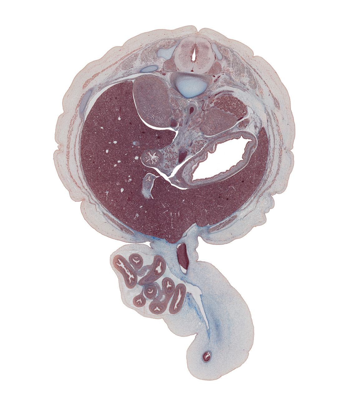 T-12 / L-1 intervertebral disc, T-12 spinal ganglion, aorta, body of dorsal pancreas, cephalic edge of gall bladder, cystic duct, descending part of duodenum, edge of left umbilical artery, extension of umbilical coelom, head of ventral pancreas, herniated intestines, inferior vena cava, left lobe of liver, origin of superior mesenteric artery, quadrate lobe of liver, right lobe of liver, superior mesenteric vein, superior pole of kidney (metanephros), sympathetic trunk, tail of dorsal pancreas, umbilical coelom, umbilical vein