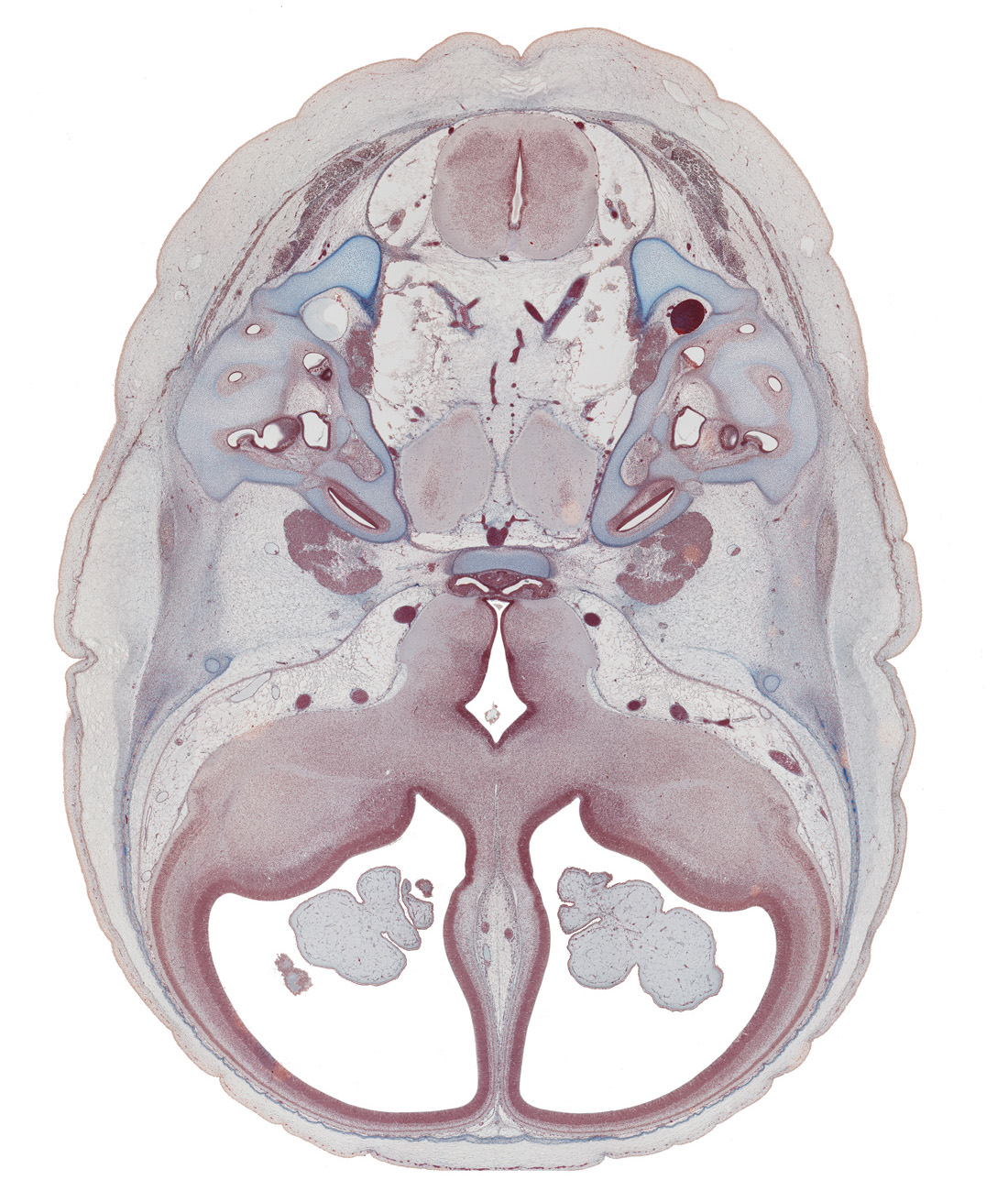 accessory nerve (CN XI), basilar artery, central canal, choroid plexus, cochlear duct, dorsum sellae, edge of pons region (metencephalon), frontal bone ossification, glossopharyngeal nerve (CN IX), hypothalamus, internal carotid artery, jugular foramen, lateral semicircular duct, lateral ventricle, lateral ventricular eminence (telencephalon), lesser wing of sphenoid, medial ventricular eminence (diencephalon), neurohypophysis, origin of abducens nerve (CN VI), posterior semicircular duct, prosencephalic septum, saccule(s), sulcus terminalis, trigeminal ganglion (CN V), vagus nerve (CN X), vestibulocochlear nerve (CN VIII)