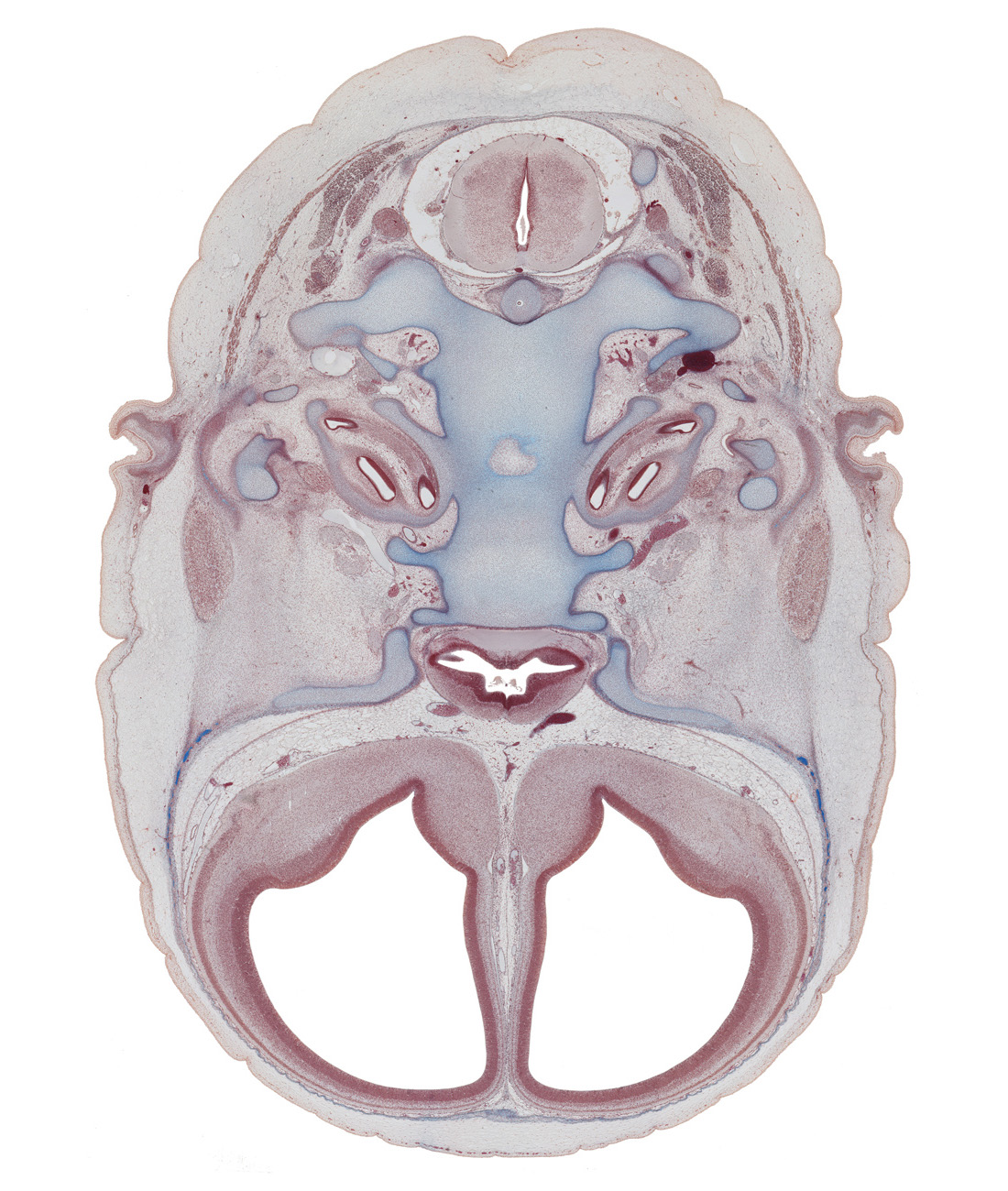 C-1 spinal ganglion, basi-occipital (basal plate), basisphenoid, edge of cranial cavity, facial nerve (CN VII), greater wing of sphenoid, hippocampus, hypoglossal canal, incus, internal carotid artery, lateral ventricle, lateral ventricular eminence (telencephalon), lesser wing of sphenoid, malleus, mandibular nerve (CN V₃), maxillary nerve (CN V₂), neural arch of C-1 vertebra (atlas), nucleus accumbens, occipital condyle, ophthalmic nerve (CN V₁), optic canal, optic chiasma (chiasmatic plate), optic groove, pre-optic area, vertebral artery
