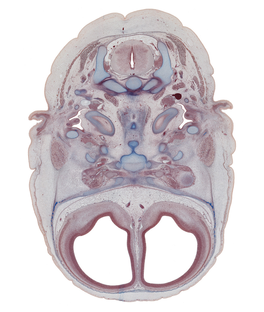 C-2 spinal ganglion, alar plate(s), anterior communicating artery, atlanto-occipital joint, basal plate, dens of C-2 vertebra (axis), edge of cochlea, edge of eyeball, extrinsic ocular muscle(s), floor plate, frontal bone ossification, lateral ventricular eminence (telencephalon), lesser wing of sphenoid, middle ear (tympanic) cavity, neural arch of C-1 vertebra (atlas), optic canal, optic nerve (CN II), optic nerve (CN II) with sheath, otic ganglion, petrous part of temporal bone (otic capsule), pharyngeal arch 2 cartilage, roof plate, sulcus limitans