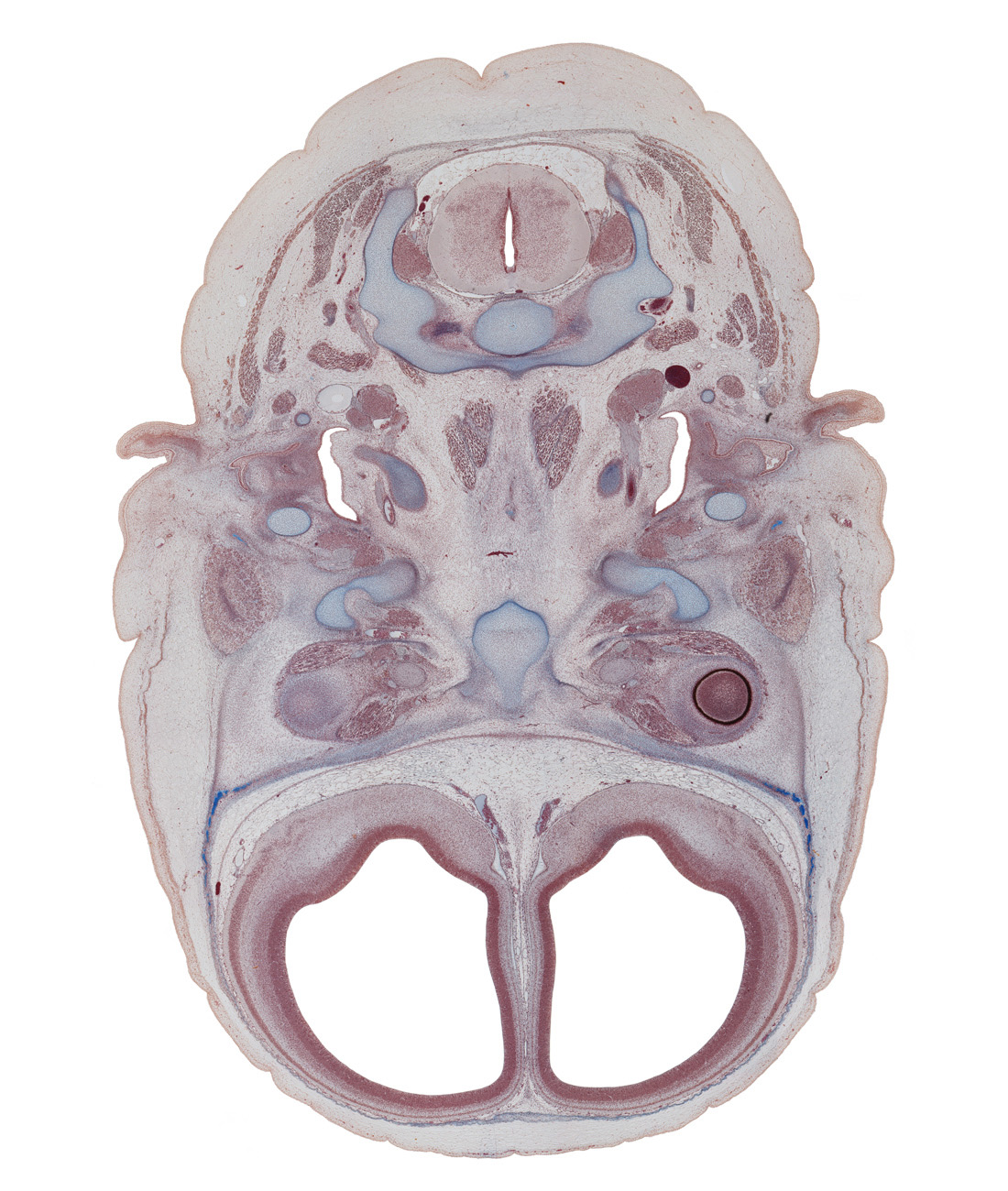 C-1 vertebra (atlas), C-2 spinal ganglion, anterior cerebral artery, ciliary ganglion, dens of C-2 vertebra (axis), edge of neural layer of retina, extrinsic ocular muscle(s), frontal bone ossification, inferior ganglion of vagus nerve (CN X), internal carotid artery, internal jugular vein, lateral ventricle, longus capitis muscle, middle ear (tympanic) cavity, semispinalis capitis muscle, sphenoid, splenius muscle, trapezius muscle, vertebral artery