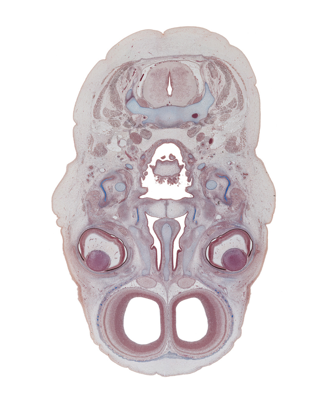 C-3 / C-4 interganglion region, centrum of C-3 vertebra, falx cerebri region, junction of palatine shelves, laryngeal pharynx, lateral pterygoid muscle, lens, nasal cavity (nasal sac), nasal septal cartilage, nasal septum, olfactory bulb, olfactory epithelium (placode), olfactory filia (CN I), oropharynx, pharyngeal arch 1 cartilage (Meckel), pharyngeal arch 2 cartilage, ramus of mandible ossification, superior nasal concha, vertebral artery